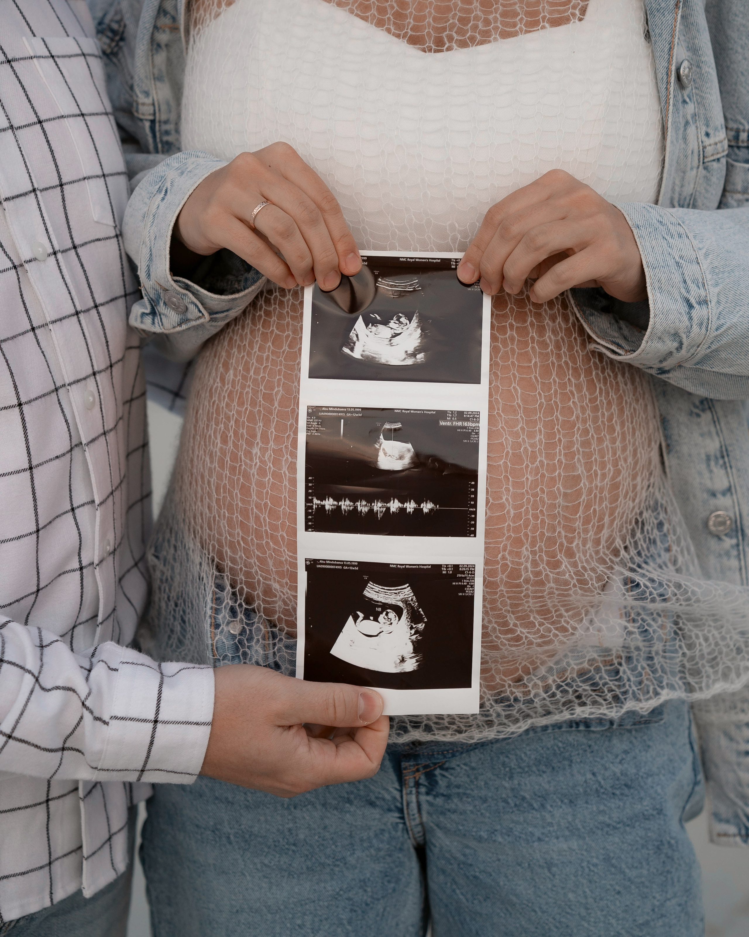 Pregnancy. Portrait Photographer