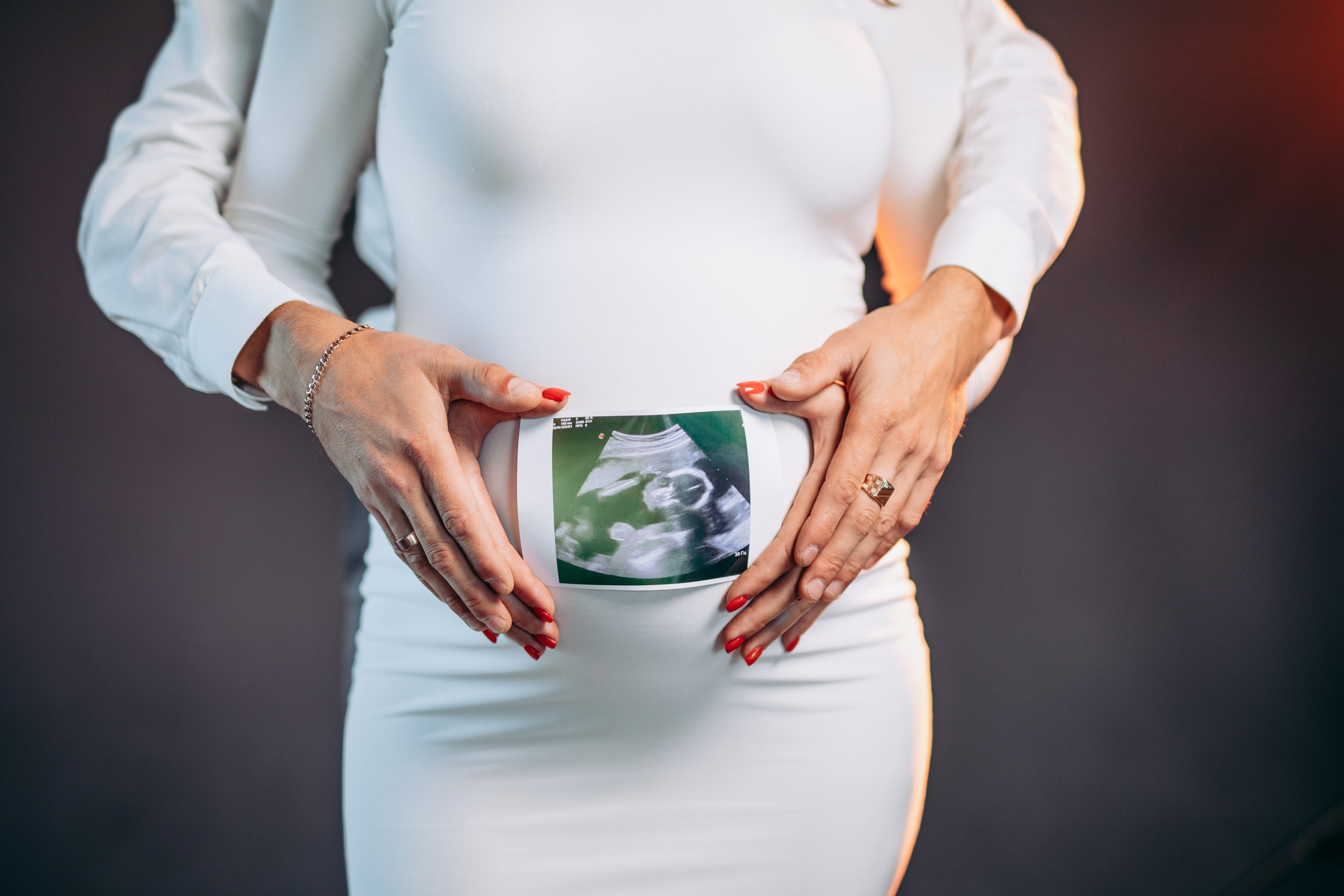 Аліна. Весільний та сімейний фотограф Марина Лисогор, м. Суми