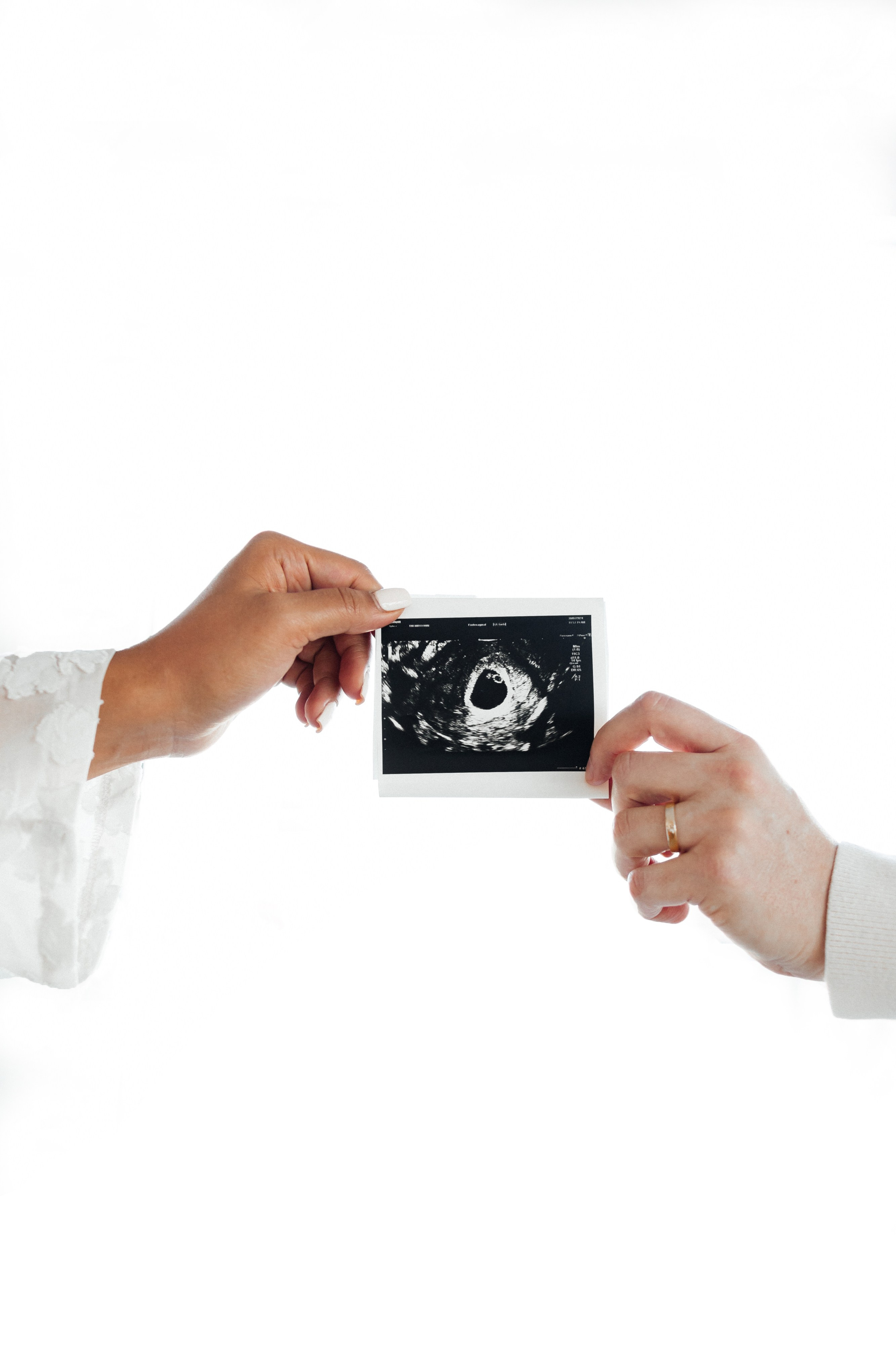 J&J. Your photographer Alina Shi