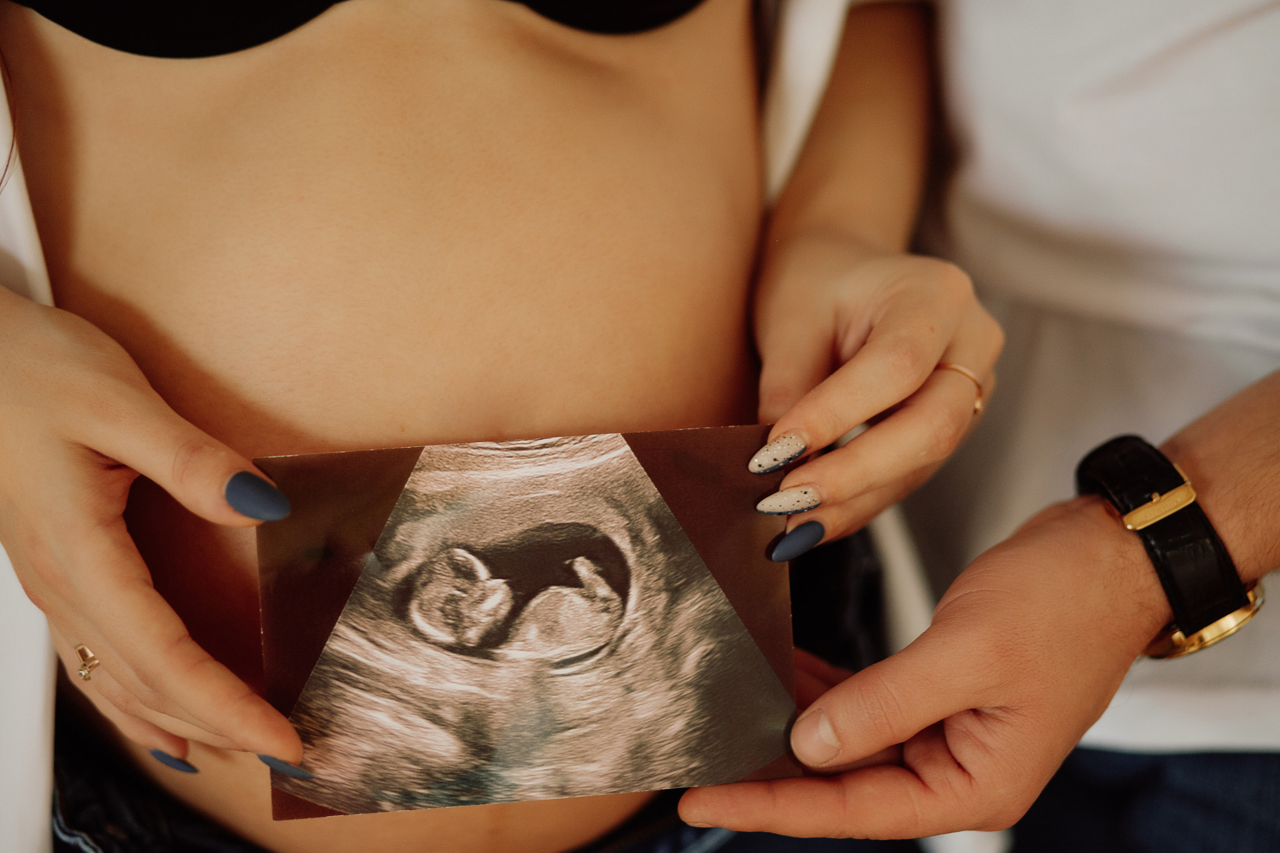 Рregnancy Natasha. Фотограф в Білій Церкві