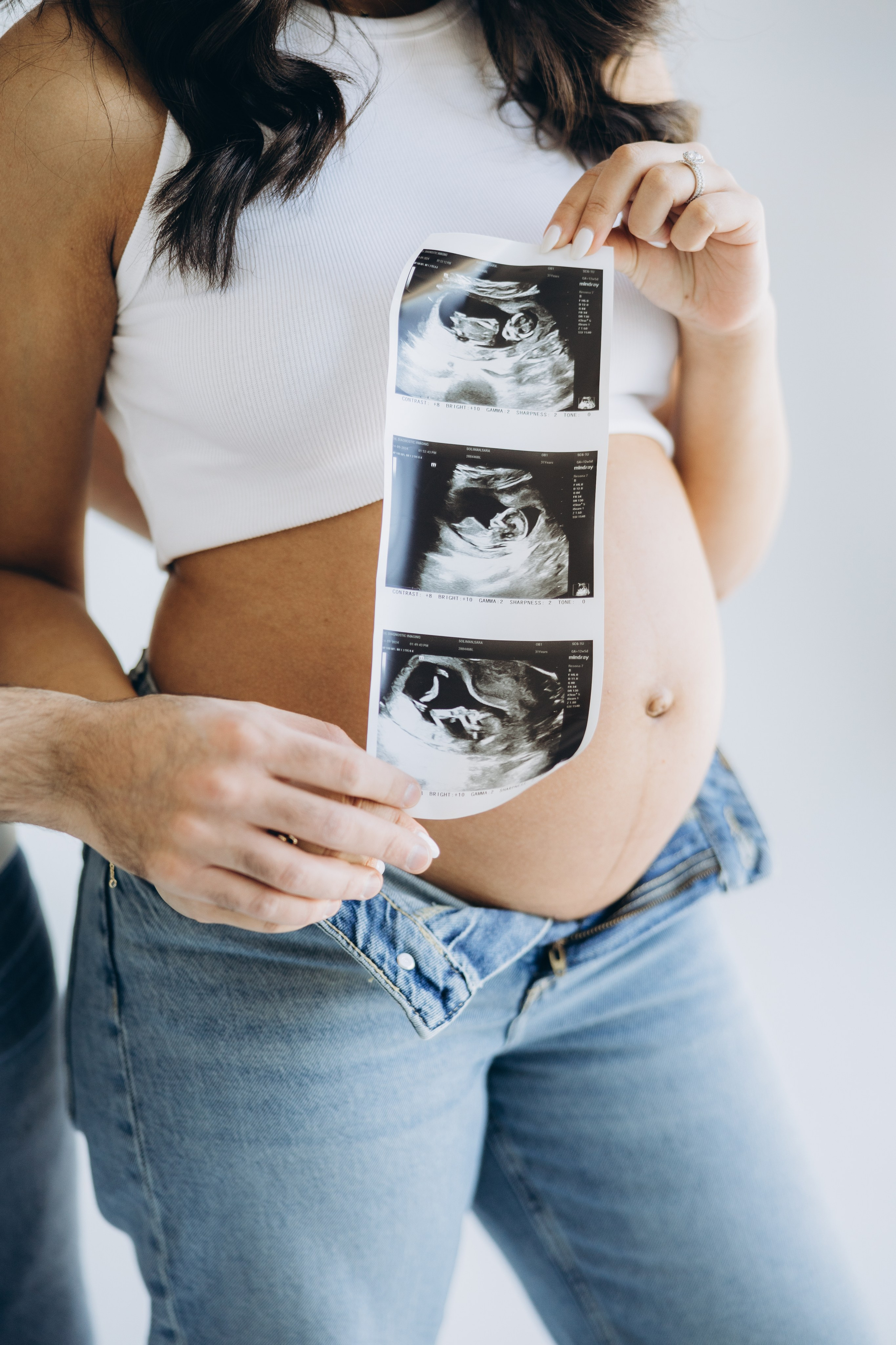 Maternity. Wedding Photographer Toronto