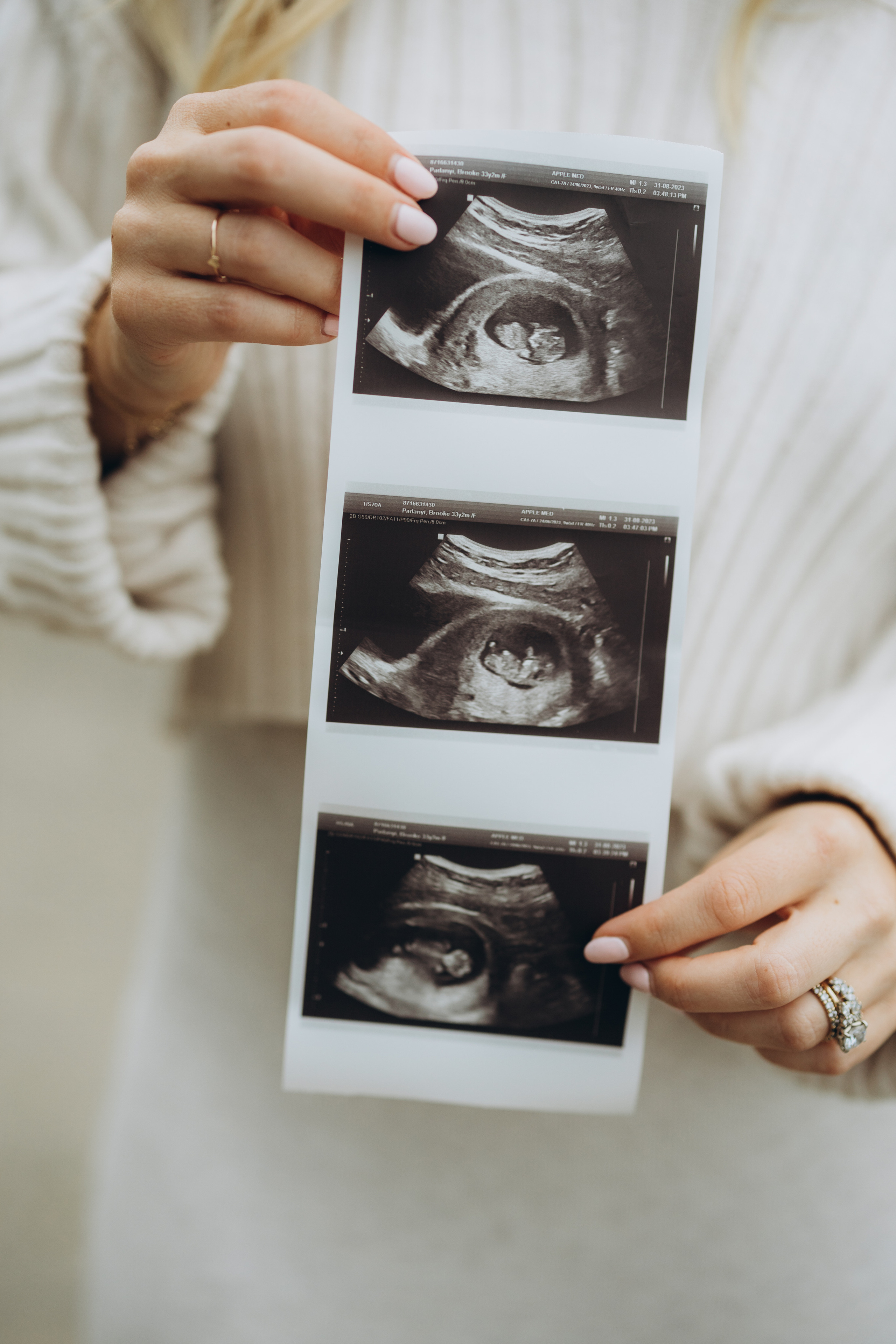 Gender party. Wedding Photographer Toronto