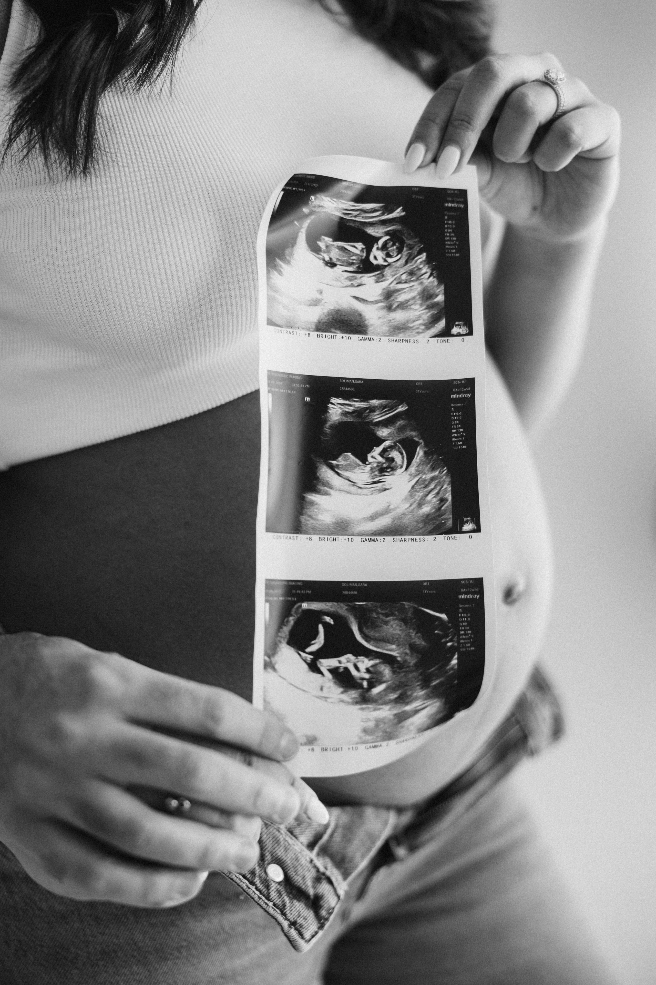 Maternity. Wedding Photographer Toronto