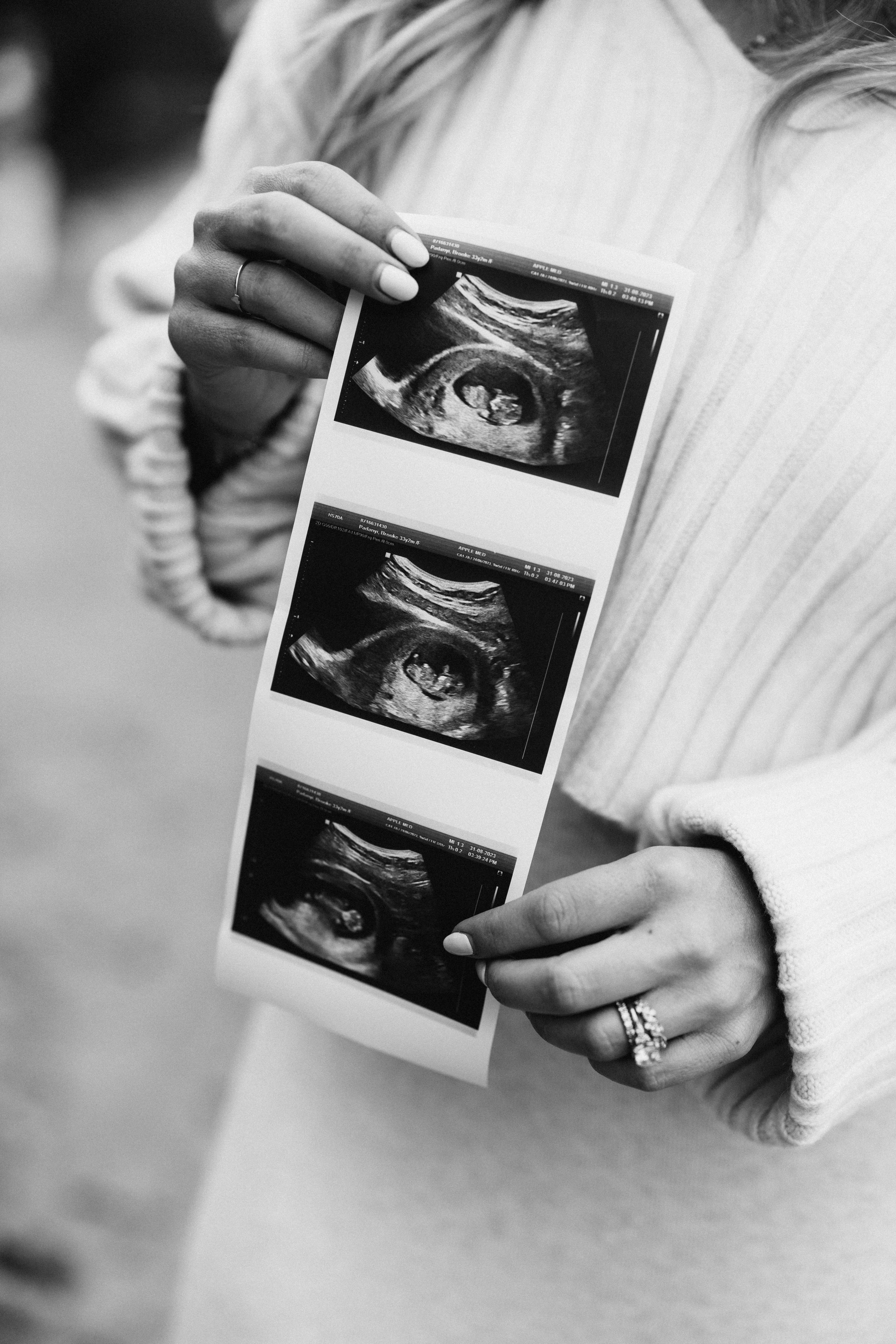 Gender party. Wedding Photographer Toronto