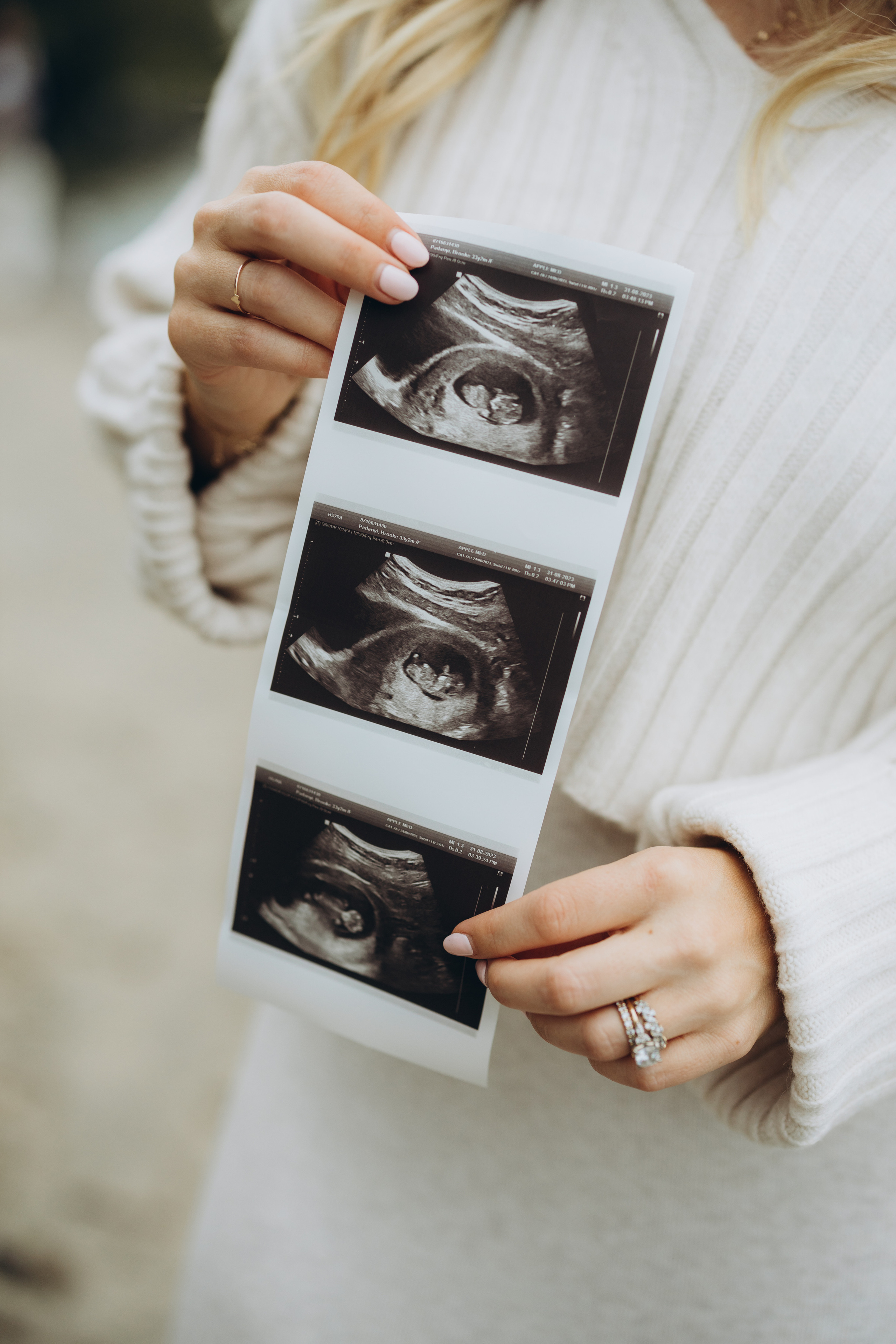 Gender party. Wedding Photographer Toronto