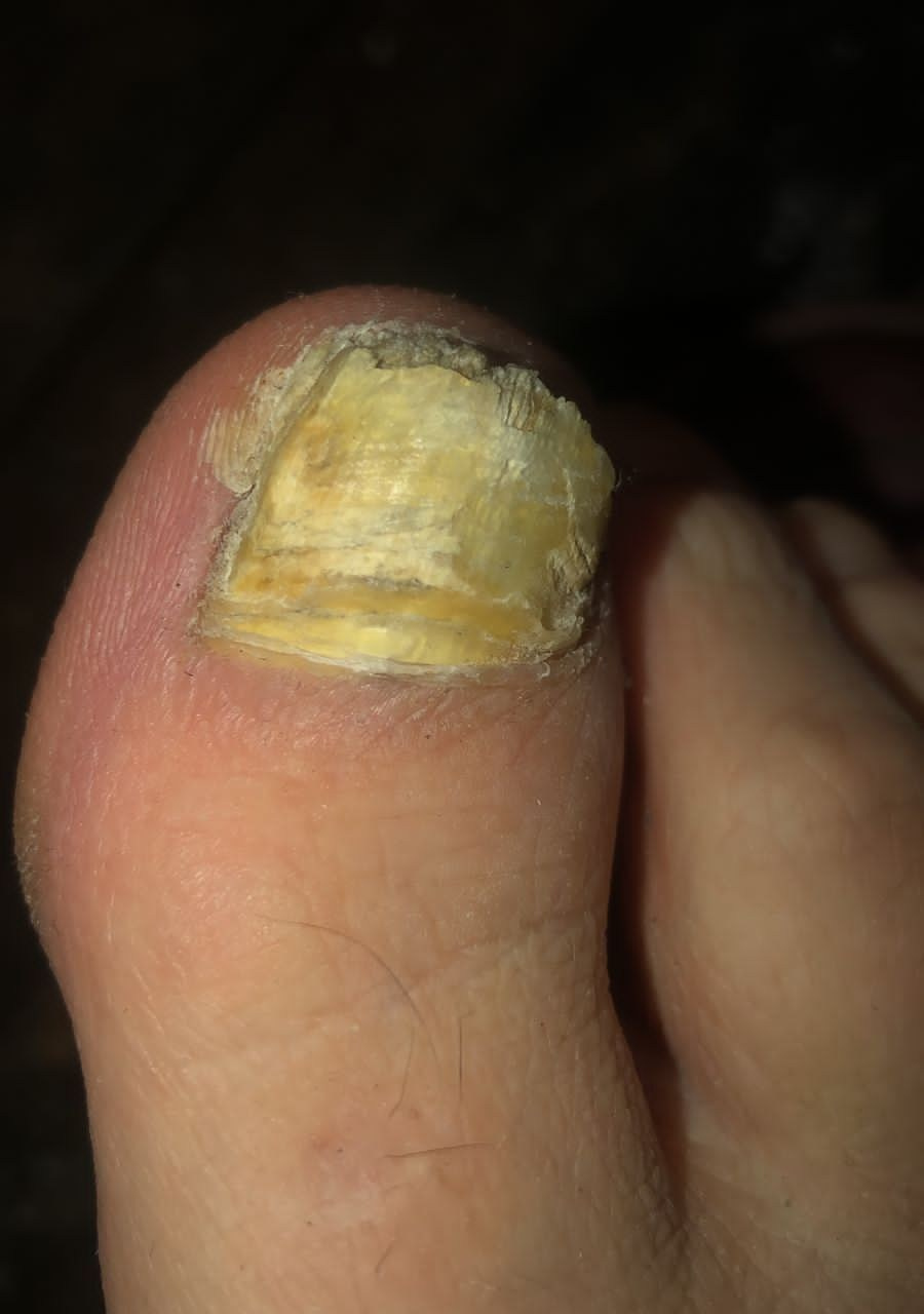 Услуги. ЦЕНТР ЗДОРОВОЙ СТОПЫ «ОКСИМА» Солнечногорск, Красноармейская, 10а, 2 э