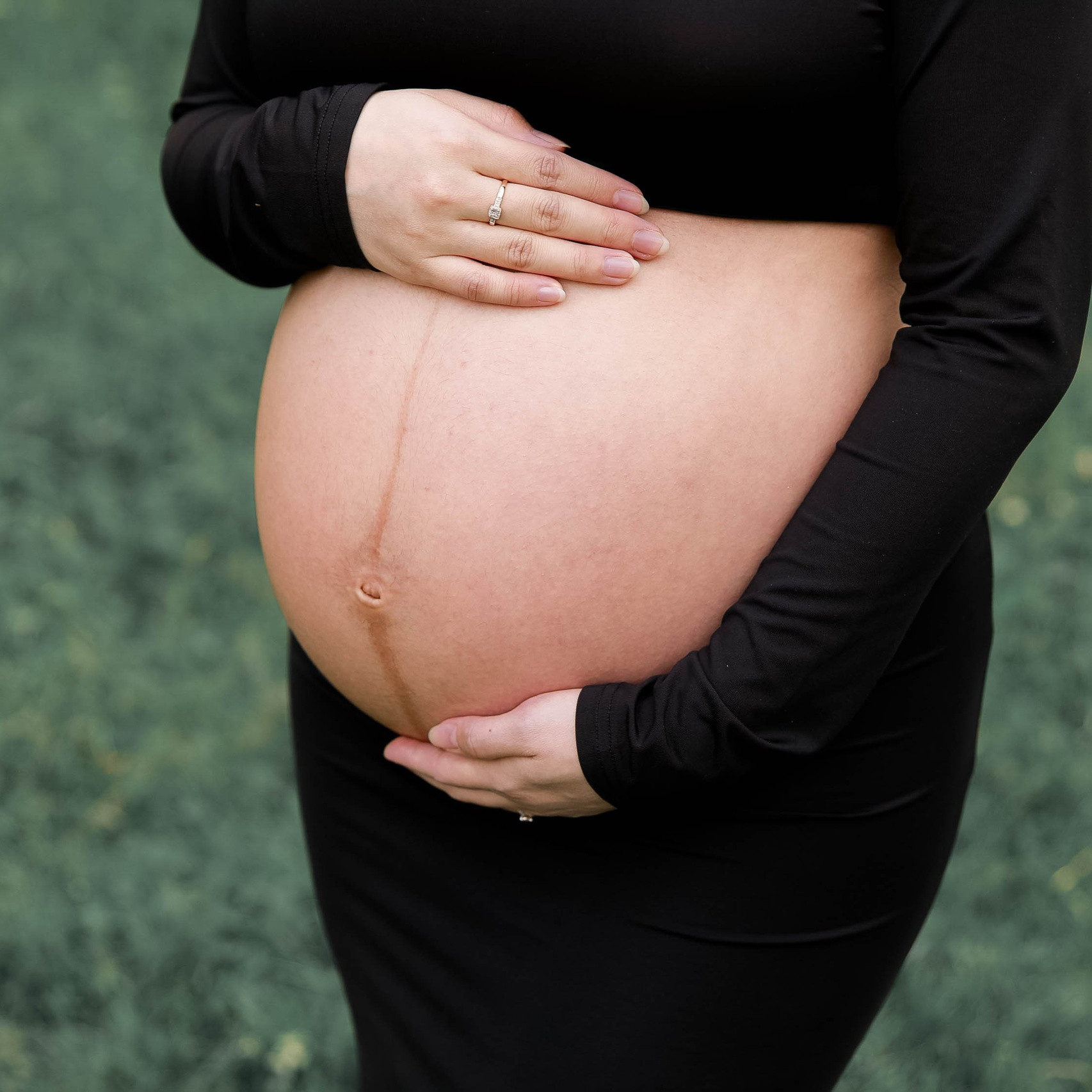 How to Prevent Stretch Marks and Keep Your Skin Healthy Before and After Birth. Silvia Stamati Photography Helsinki