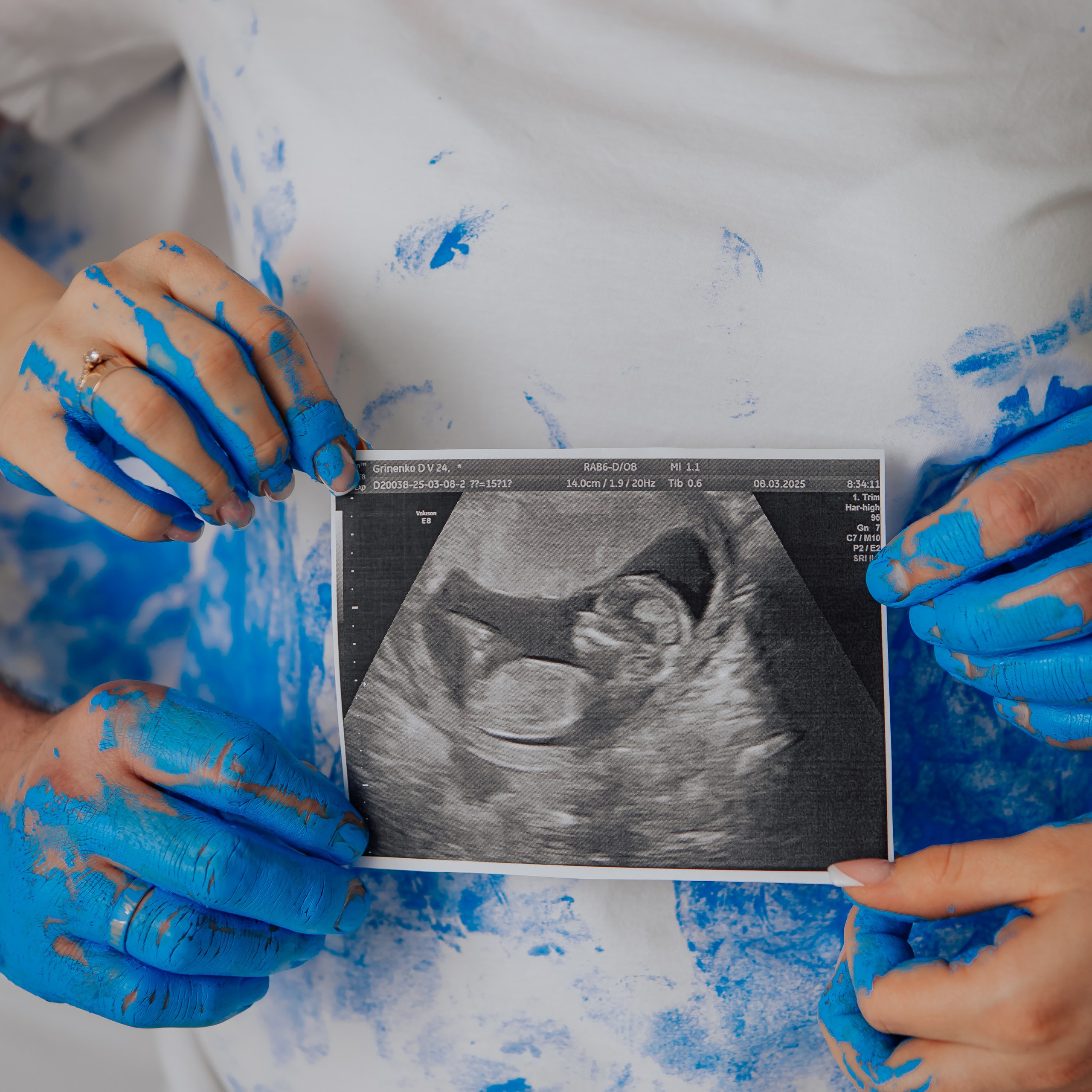 Фотосесія Вагітності