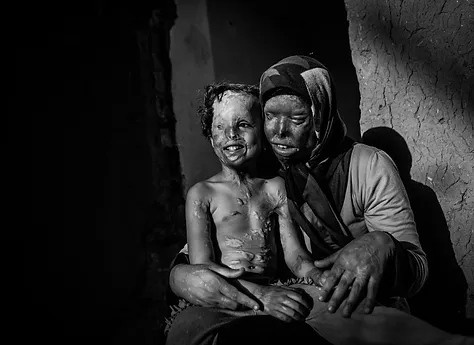 The Bar-Tur Photo Award 2022. Misha Maslennikov. Documentary photography. Odessa