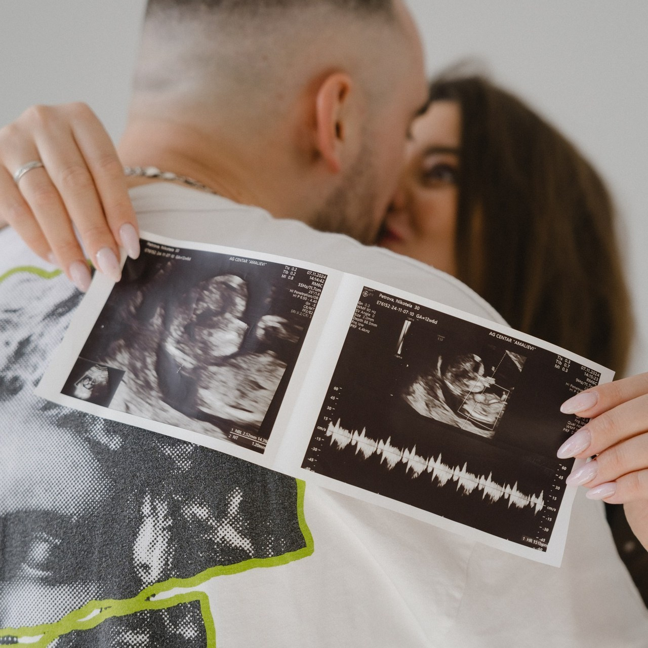 ОБРАТНА ВРЪЗКА. Сватбен фотограф Анна Златева