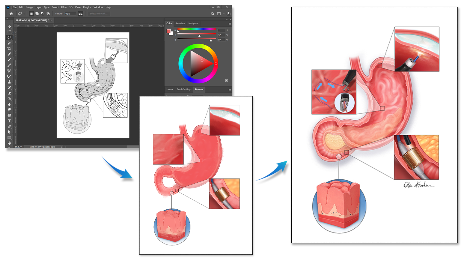 Professional Medical Illustrator for Hire | Olga Kurkina