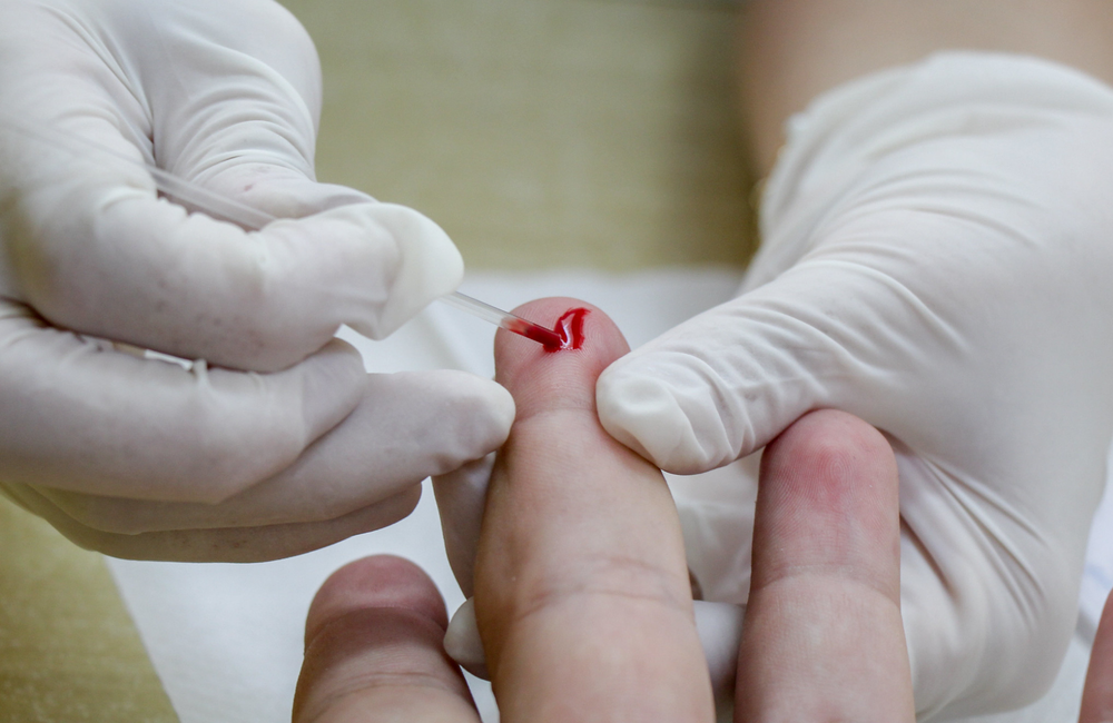 HIV-kiirtestimise ja ravisoostumuse teenused Eestis