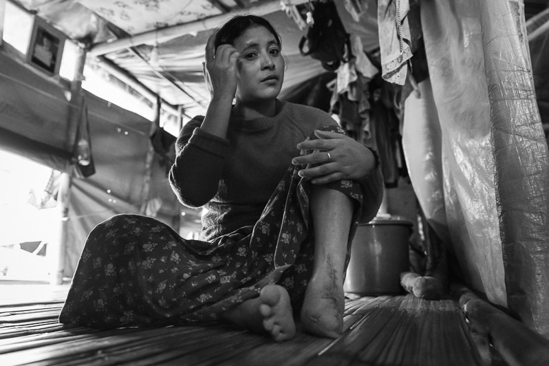 Landmines is one of the main reasons why people cannot go back to their villages, Myo Oo IDP camp, Namti, Mogaung township, Mohnyin district, Kachin state, Myanmar. September 2019