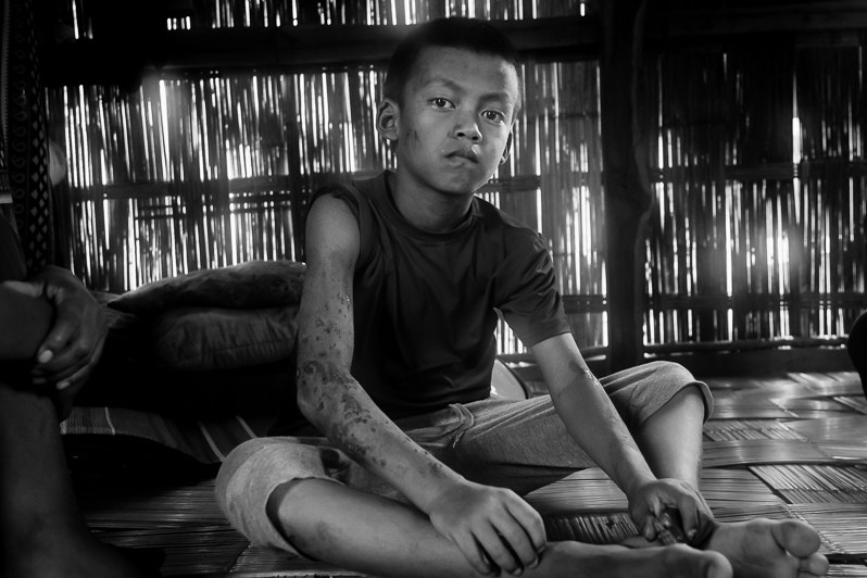 Chin refugee living in a refugee camp in Mizoram arrived from Matopi in Chin State in Myanmar, Mizoram state, India. October 2022