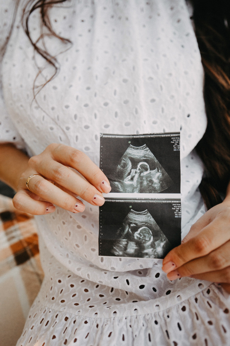 Валерія і Дмитро. Головна