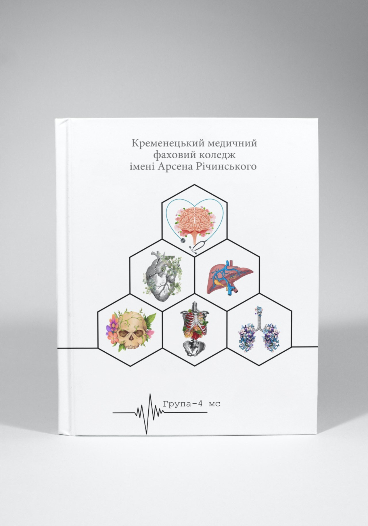 Випускні альбоми Тернопіль. Випускні альбоми Тернопіль