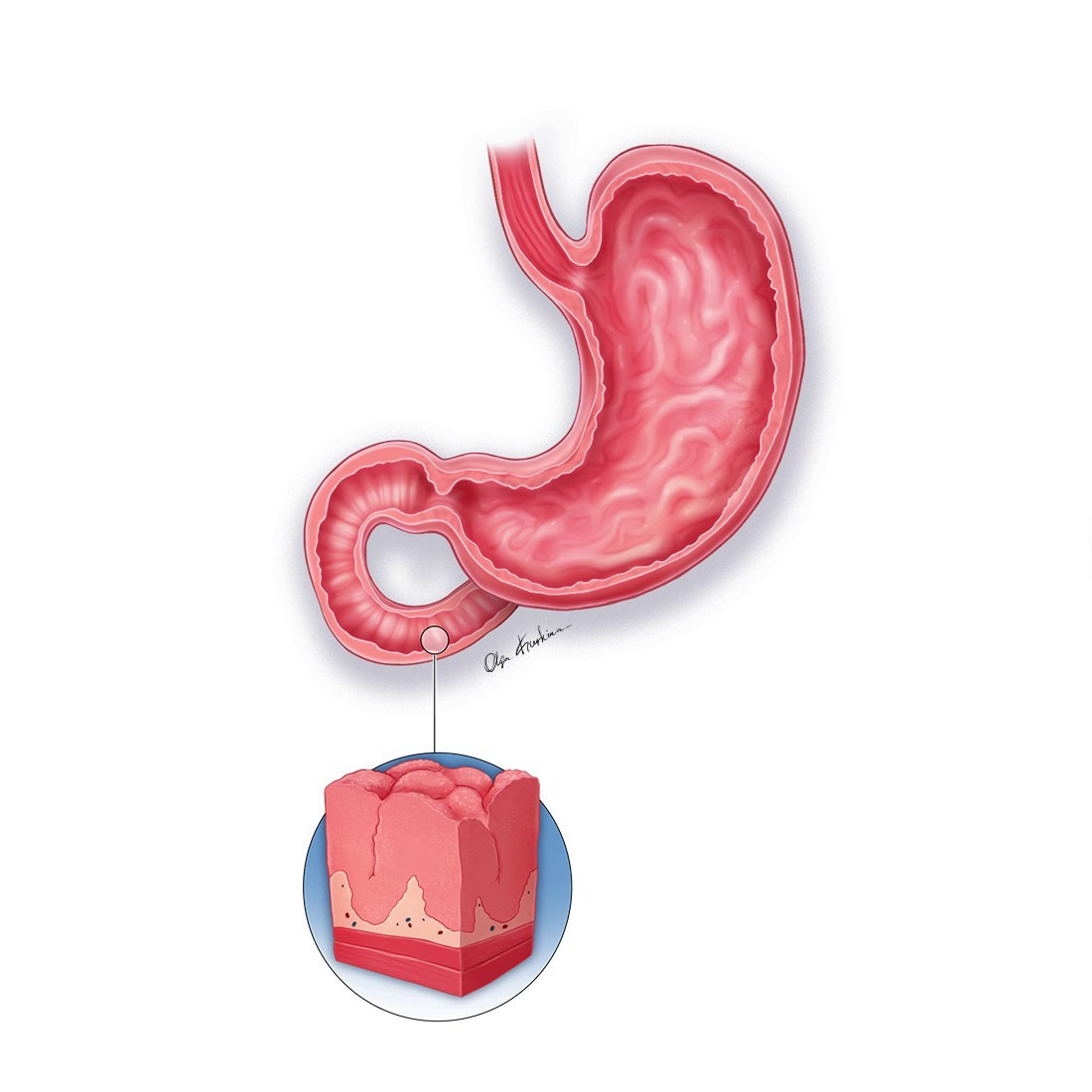 Professional freelance medical illustrator