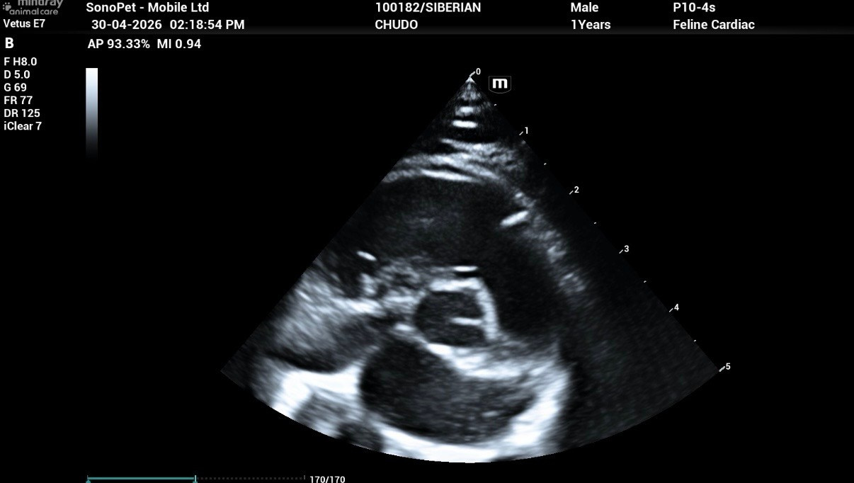 Echocardiogram Report of Chudo: Normal on 30 Apr 2026