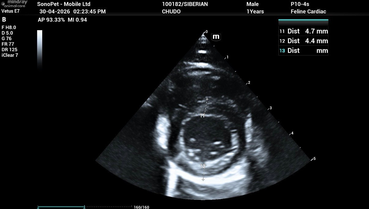 Echocardiogram Report of Chudo: Normal on 30 Apr 2026