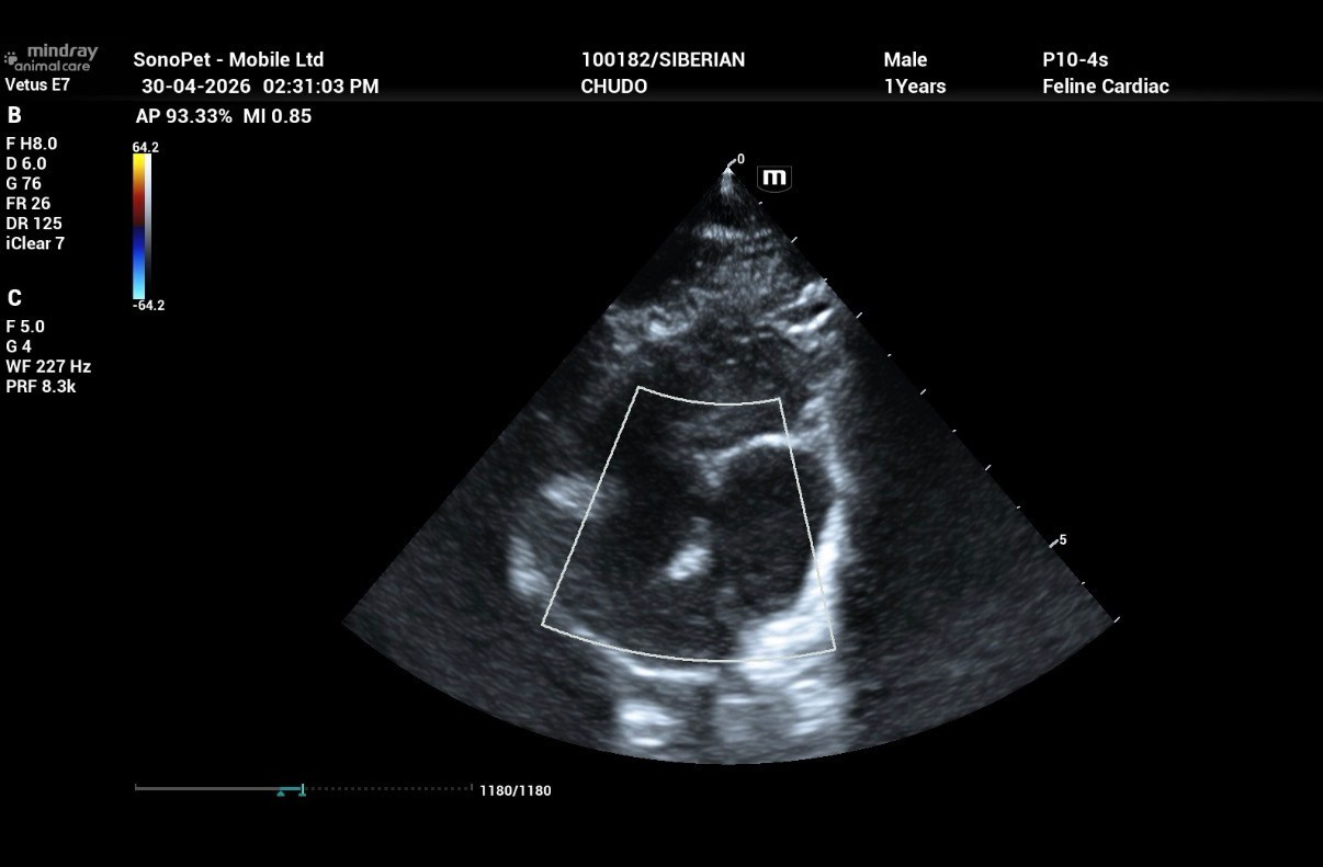 Echocardiogram Report of Chudo: Normal on 30 Apr 2026