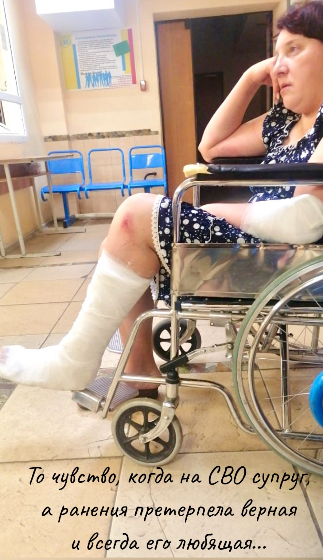 У Наташи три перелома. Вернов Продюксьон & АККА Мьюзик в ассоциации CASIDAF & BRUCEF