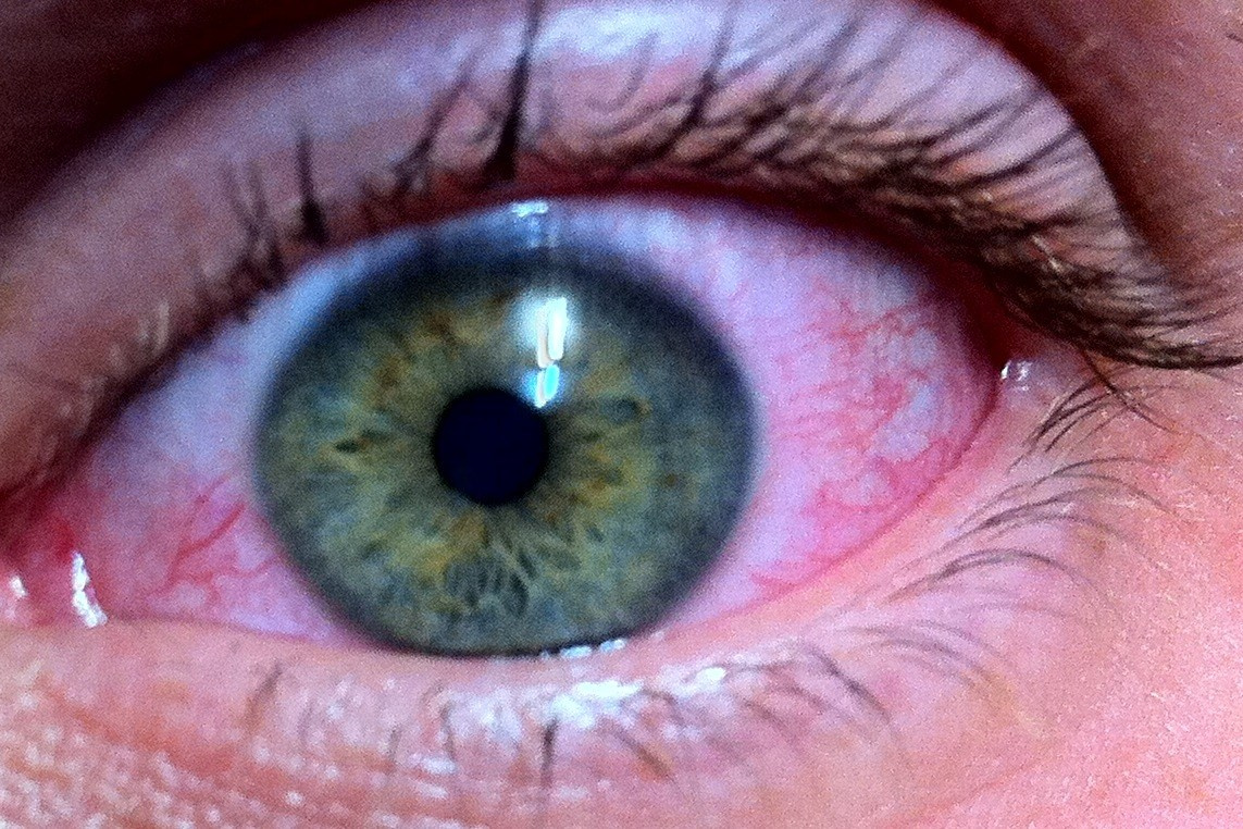 Everything from everything