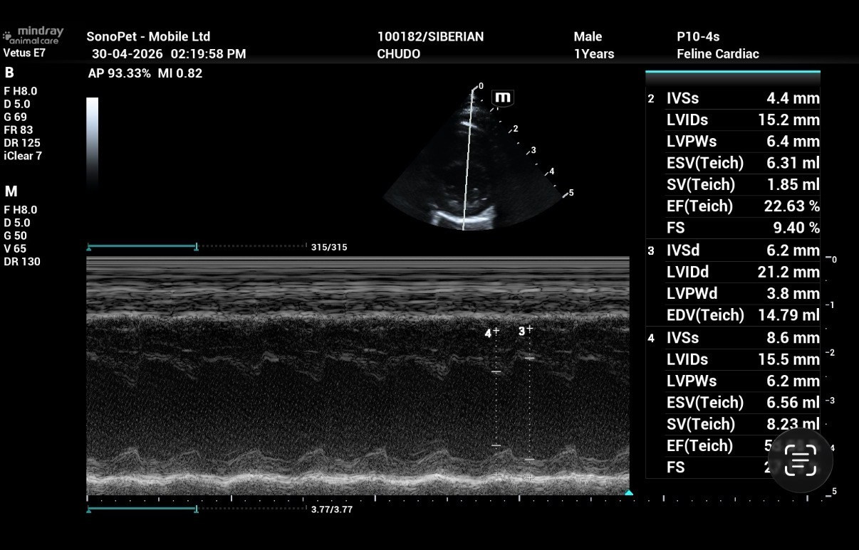Echocardiogram Report of Chudo: Normal on 30 Apr 2026