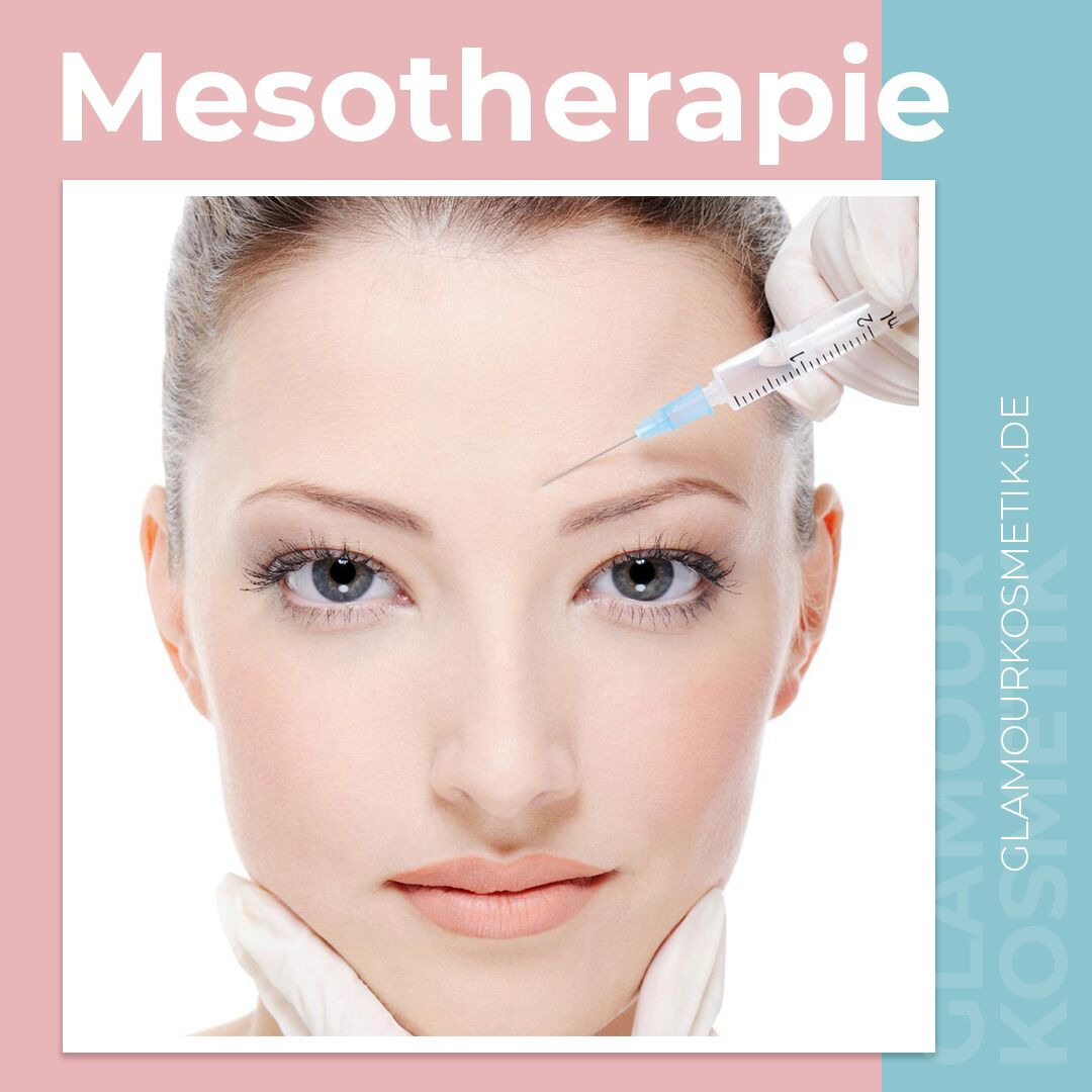 Instagram. Рекламное агентство в Германии