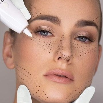 Innovatives Plasmalifting für strahlende Haut. Studio Perfekto in Stuttgart Feuerbach bietet effektive Behandlungen zur Tattoo-Entfernung, Papillomentfernung und Hautregeneration – für ein frisches und jugendliches Aussehen. Innovative plasma lifting for radiant skin. Studio Perfekto in Stuttgart Feuerbach provides effective treatments for tattoo removal, papilloma removal, and skin rejuvenation – for a fresh and youthful appearance. Инновационный плазмолифтинг для сияющей кожи. Studio Perfekto в Штутгарте-Фойербахе предлагает удаление татуировок, папиллом и омоложение кожи для свежего и молодого вида.