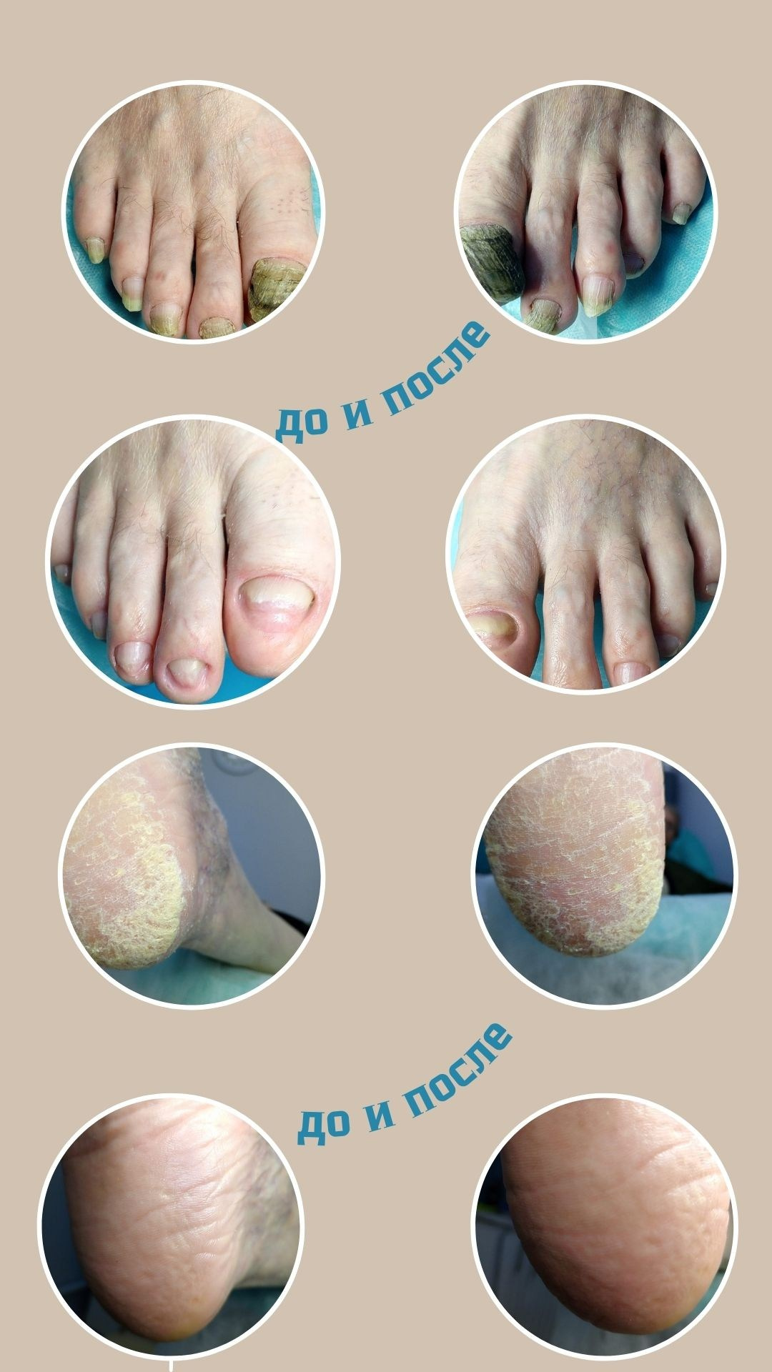 ЦЕНТР ЗДОРОВОЙ СТОПЫ «ОКСИМА» Солнечногорск, Красноармейская, 10а, 2 э