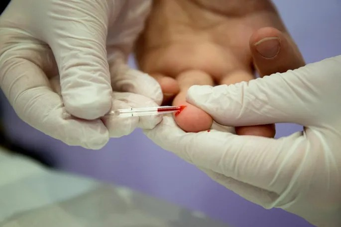 HIV-kiirtestimise ja ravisoostumuse teenused Eestis