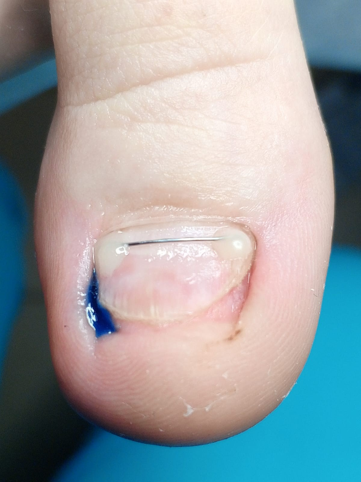 Услуги. ЦЕНТР ЗДОРОВОЙ СТОПЫ «ОКСИМА» Солнечногорск, Красноармейская, 10а, 2 э