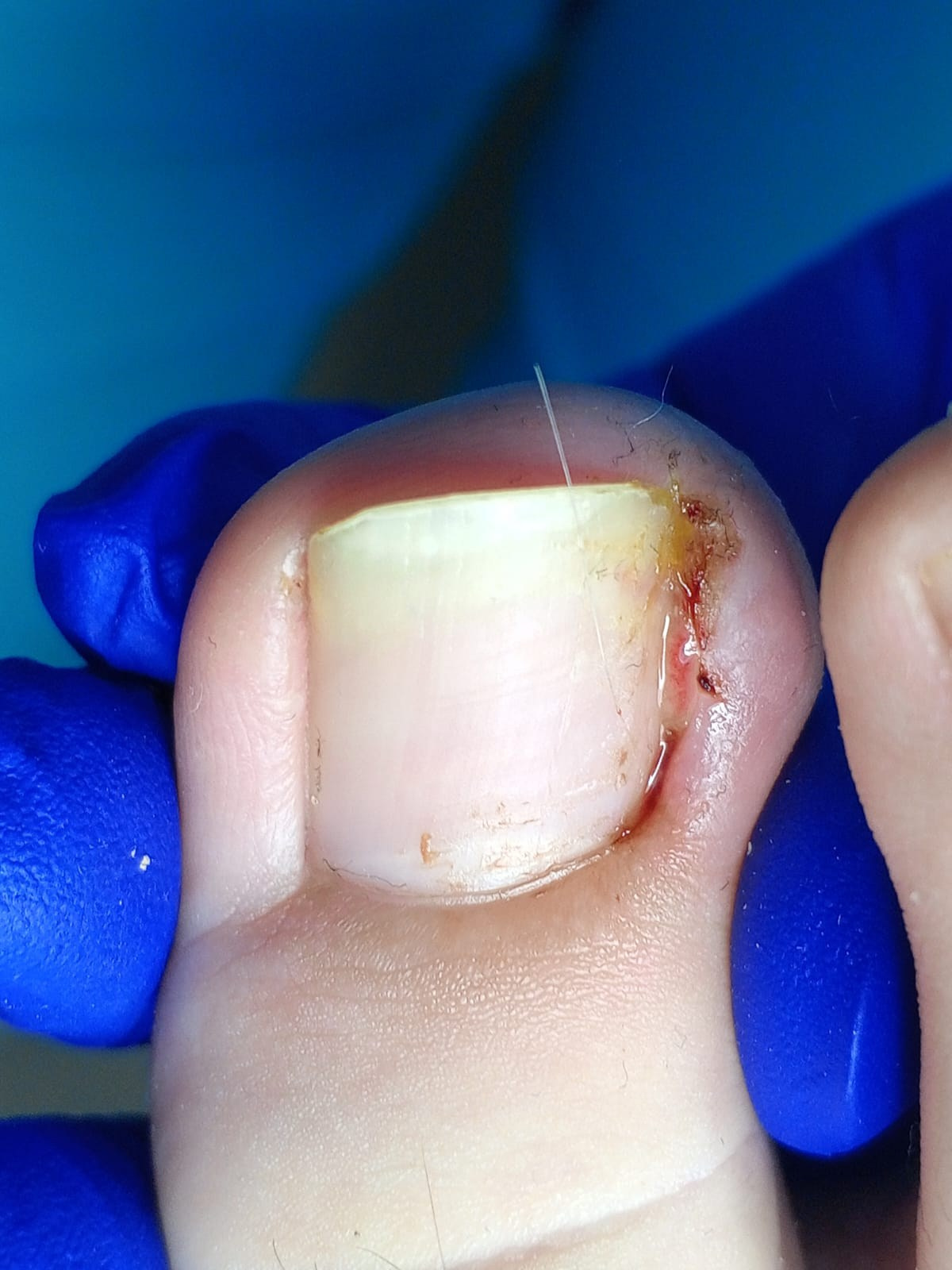 Услуги. ЦЕНТР ЗДОРОВОЙ СТОПЫ «ОКСИМА» Солнечногорск, Красноармейская, 10а, 2 э