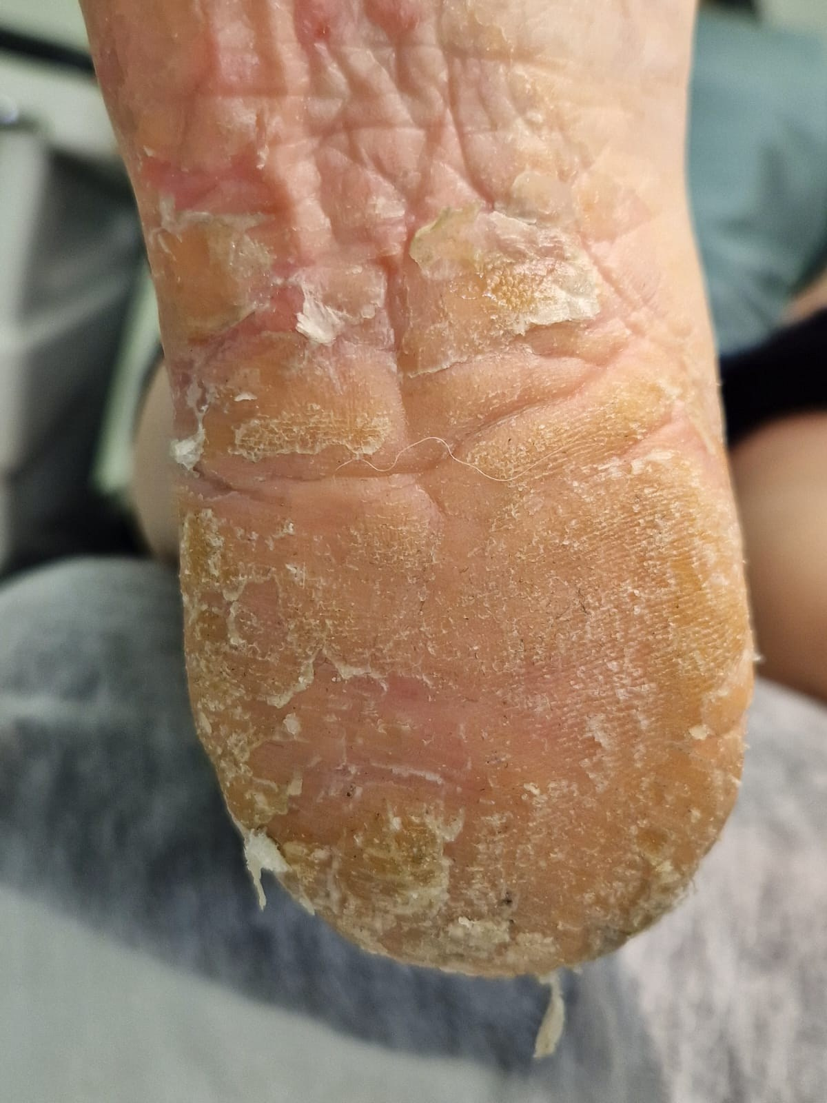 Услуги. ЦЕНТР ЗДОРОВОЙ СТОПЫ «ОКСИМА» Солнечногорск, Красноармейская, 10а, 2 э