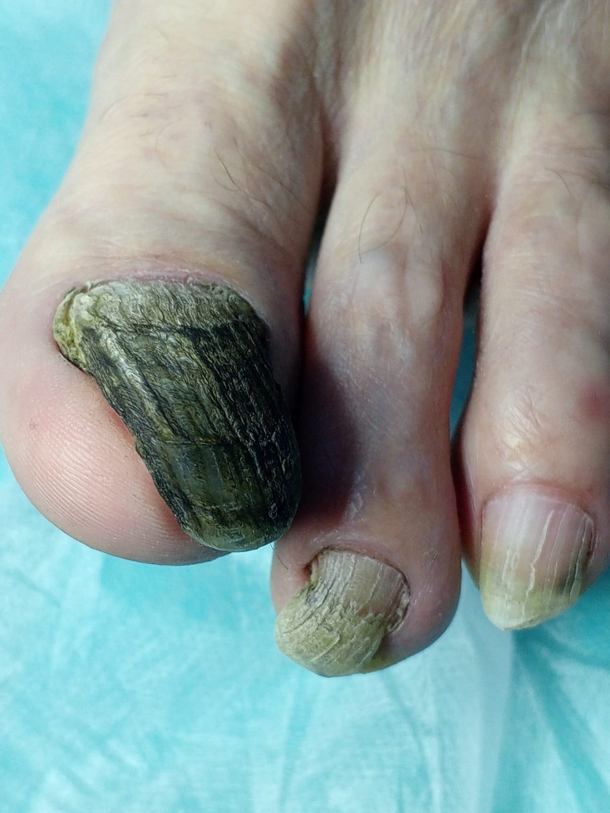 Услуги. ЦЕНТР ЗДОРОВОЙ СТОПЫ «ОКСИМА» Солнечногорск, Красноармейская, 10а, 2 э