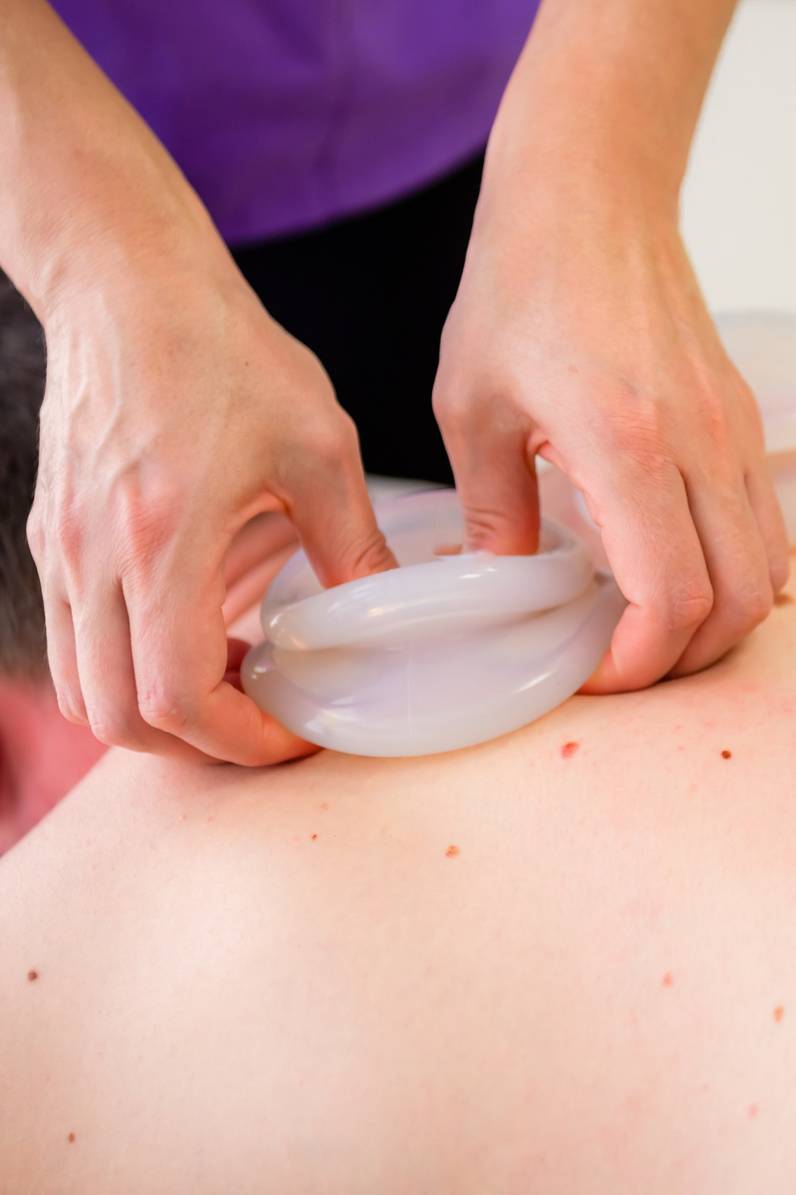 Ventuzoterapie. Newsportevents- Recuperare & Relaxare, Kinetoterapie, Masaj, Refacere, Stretching, Osteopatie, Recuperare, Tecar