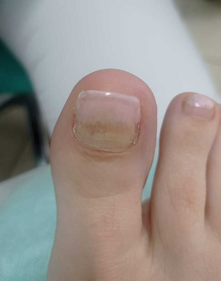 Услуги. ЦЕНТР ЗДОРОВОЙ СТОПЫ «ОКСИМА» Солнечногорск, Красноармейская, 10а, 2 э