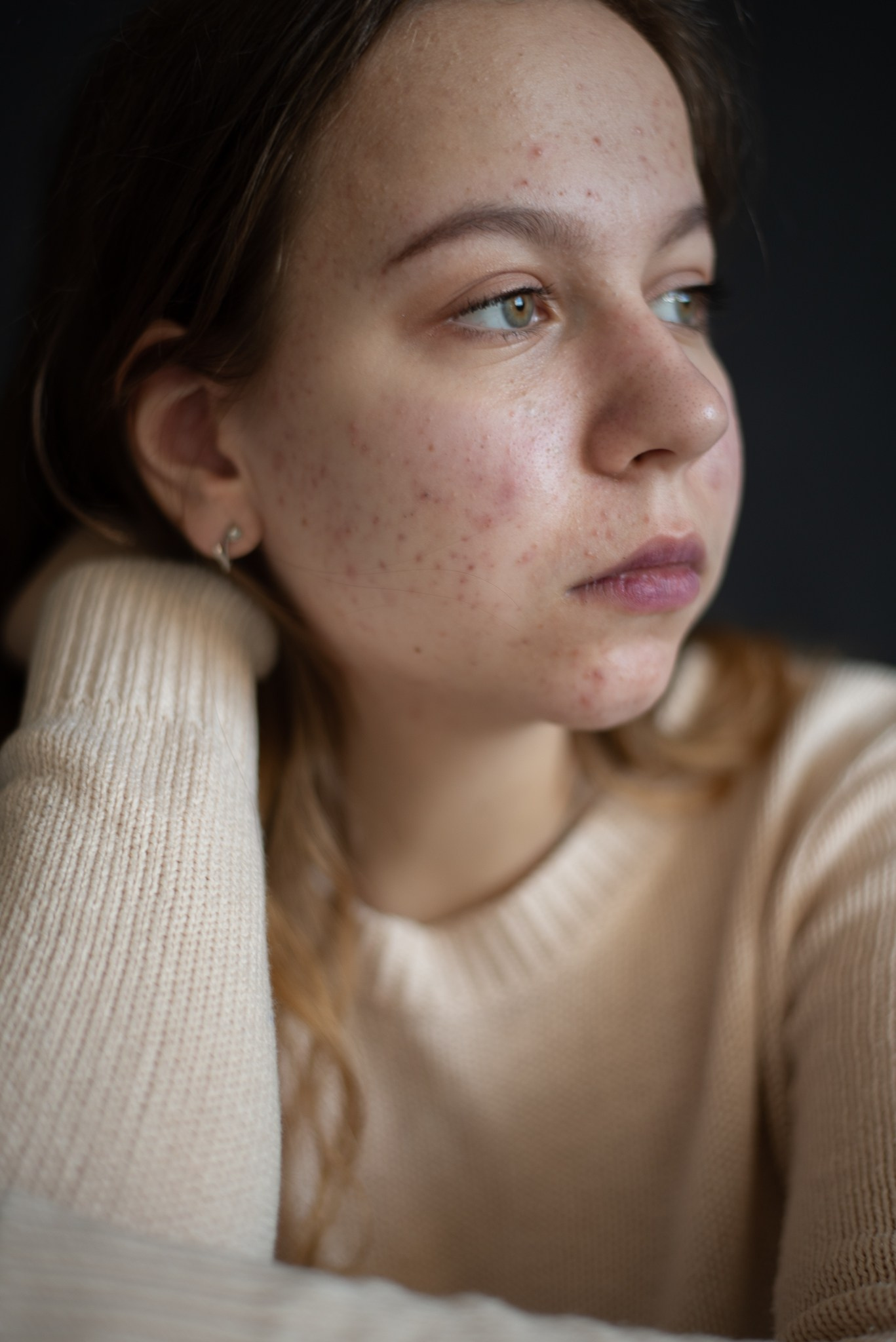 Skin. Документальный и репортажный фотограф Айгуль Михайлова