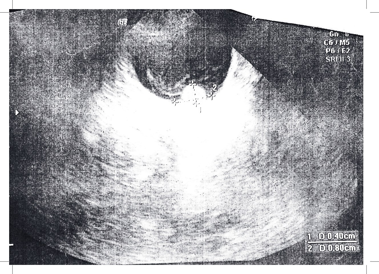 Малетина. DOCULAB — Лаборатория документальной фотографии в Берлине