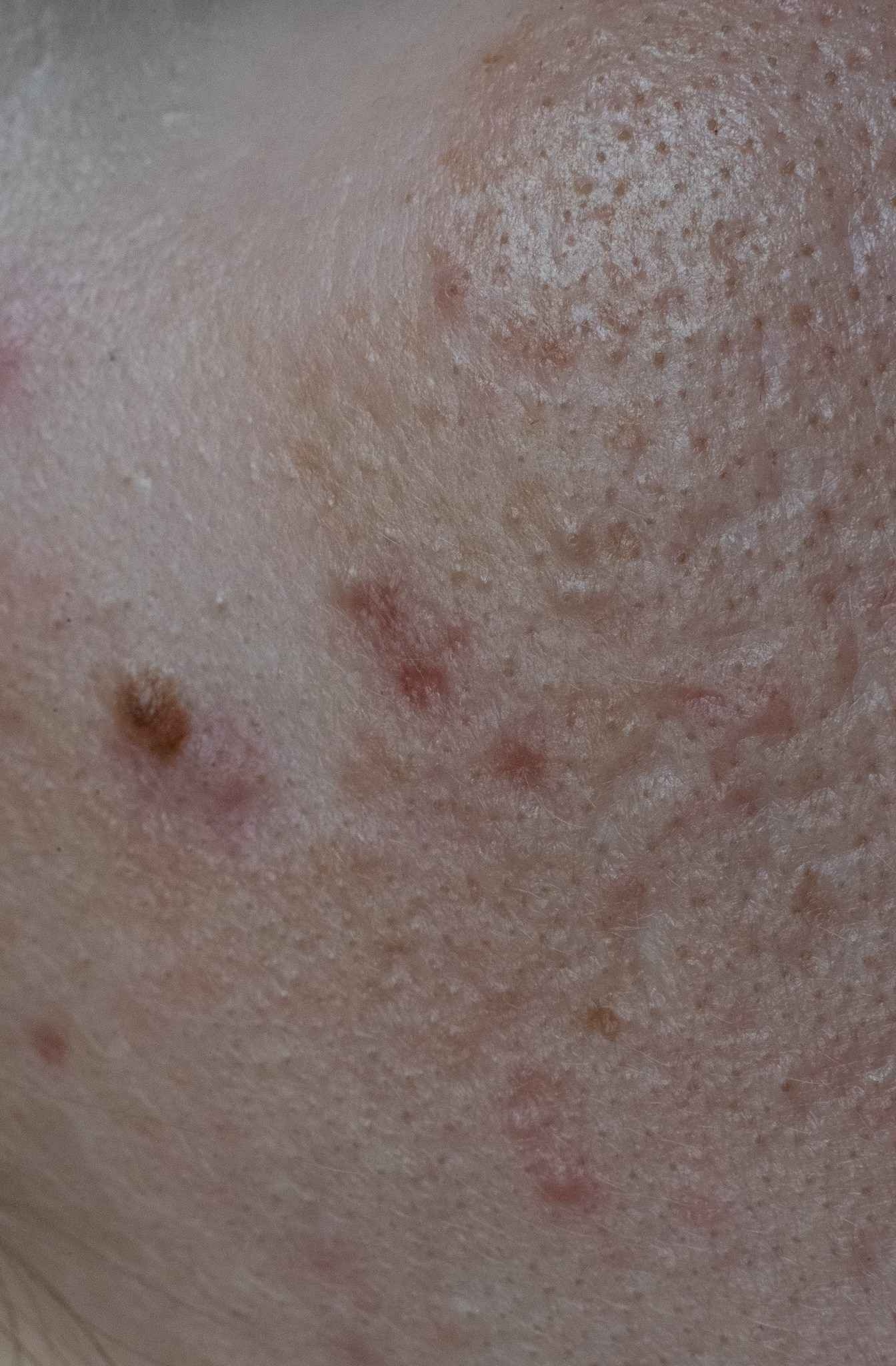 Skin. Документальный и репортажный фотограф Айгуль Михайлова