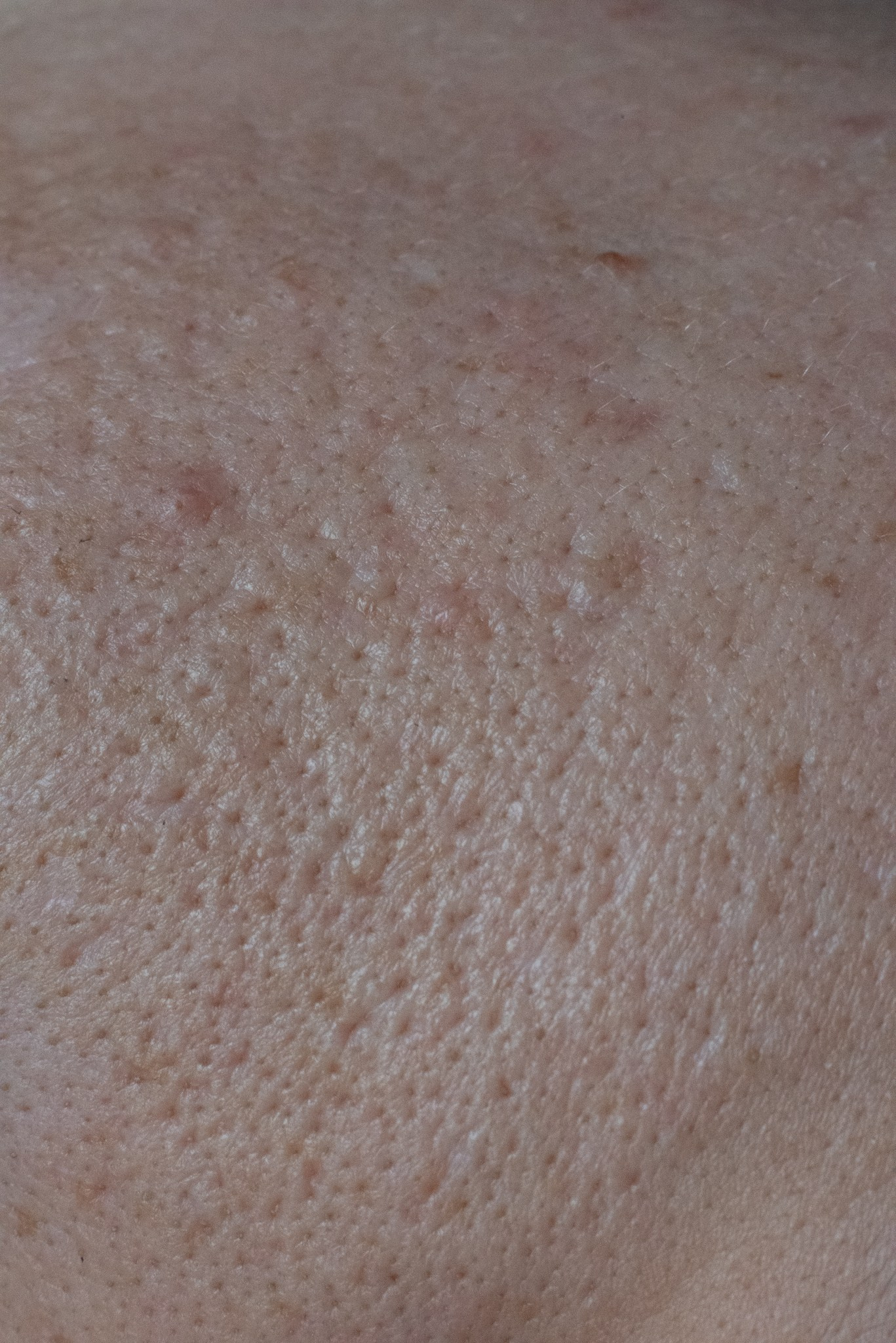 Skin. Документальный и репортажный фотограф Айгуль Михайлова