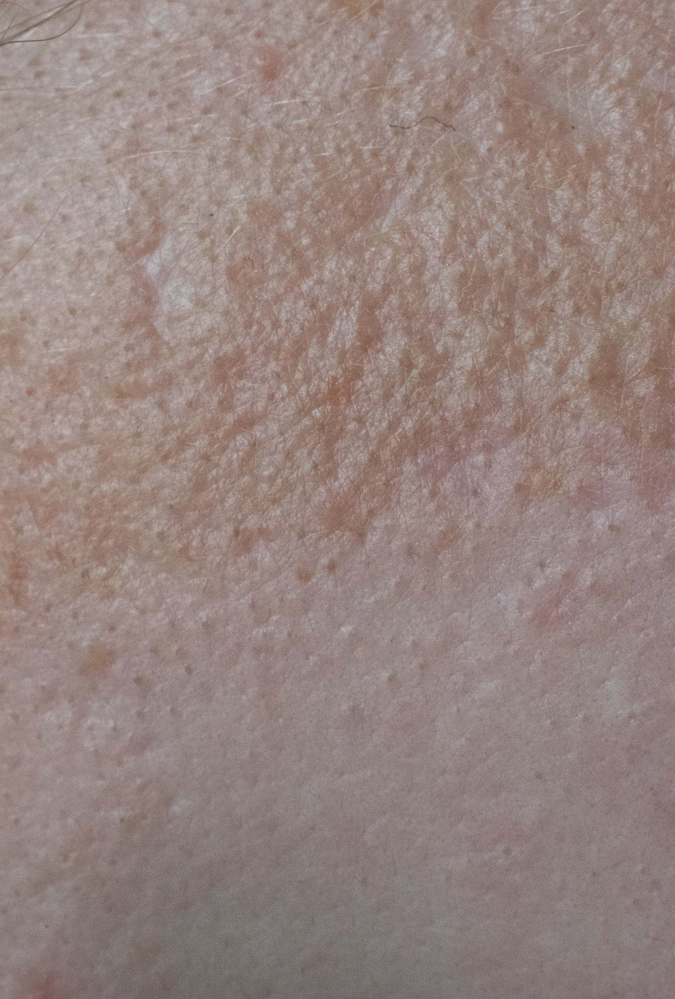 Skin. Документальный и репортажный фотограф Айгуль Михайлова