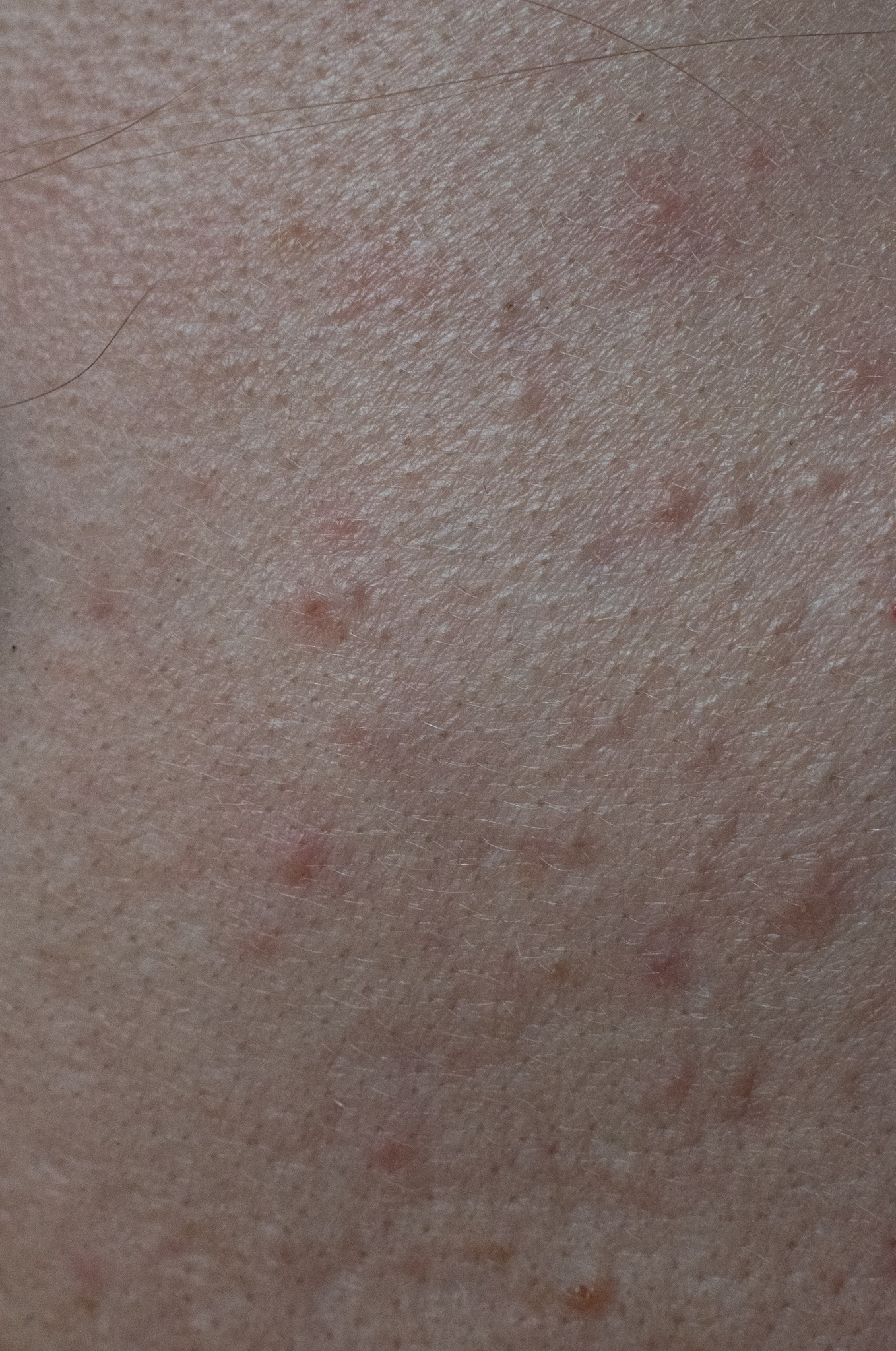 Skin. Документальный и репортажный фотограф Айгуль Михайлова