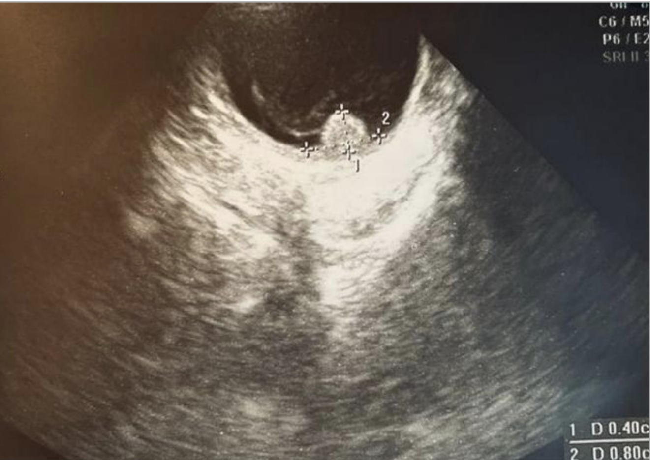 Малетина. Документальный фотограф, преподаватель в Берлине Андрей Словолитов