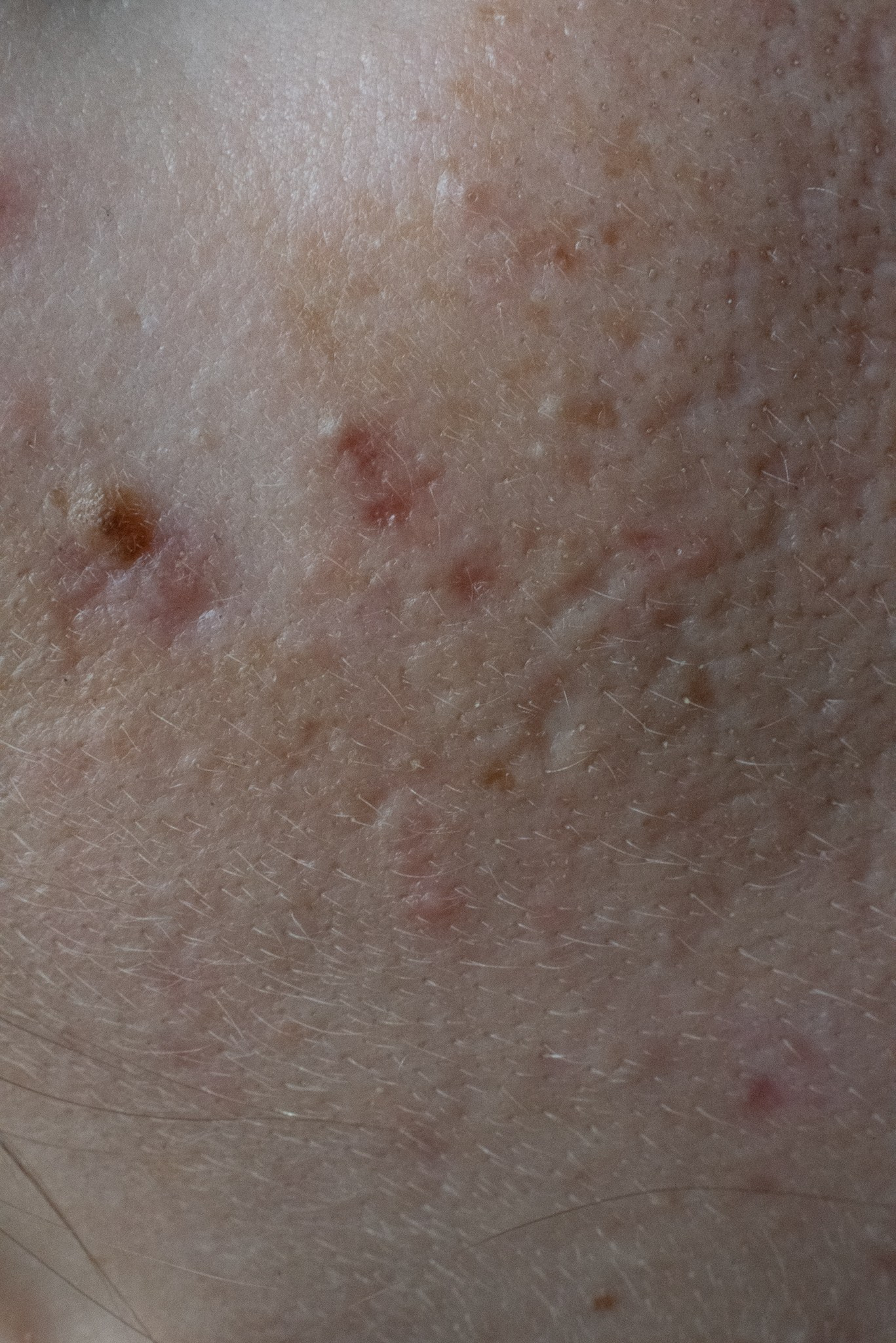 Skin. Документальный и репортажный фотограф Айгуль Михайлова