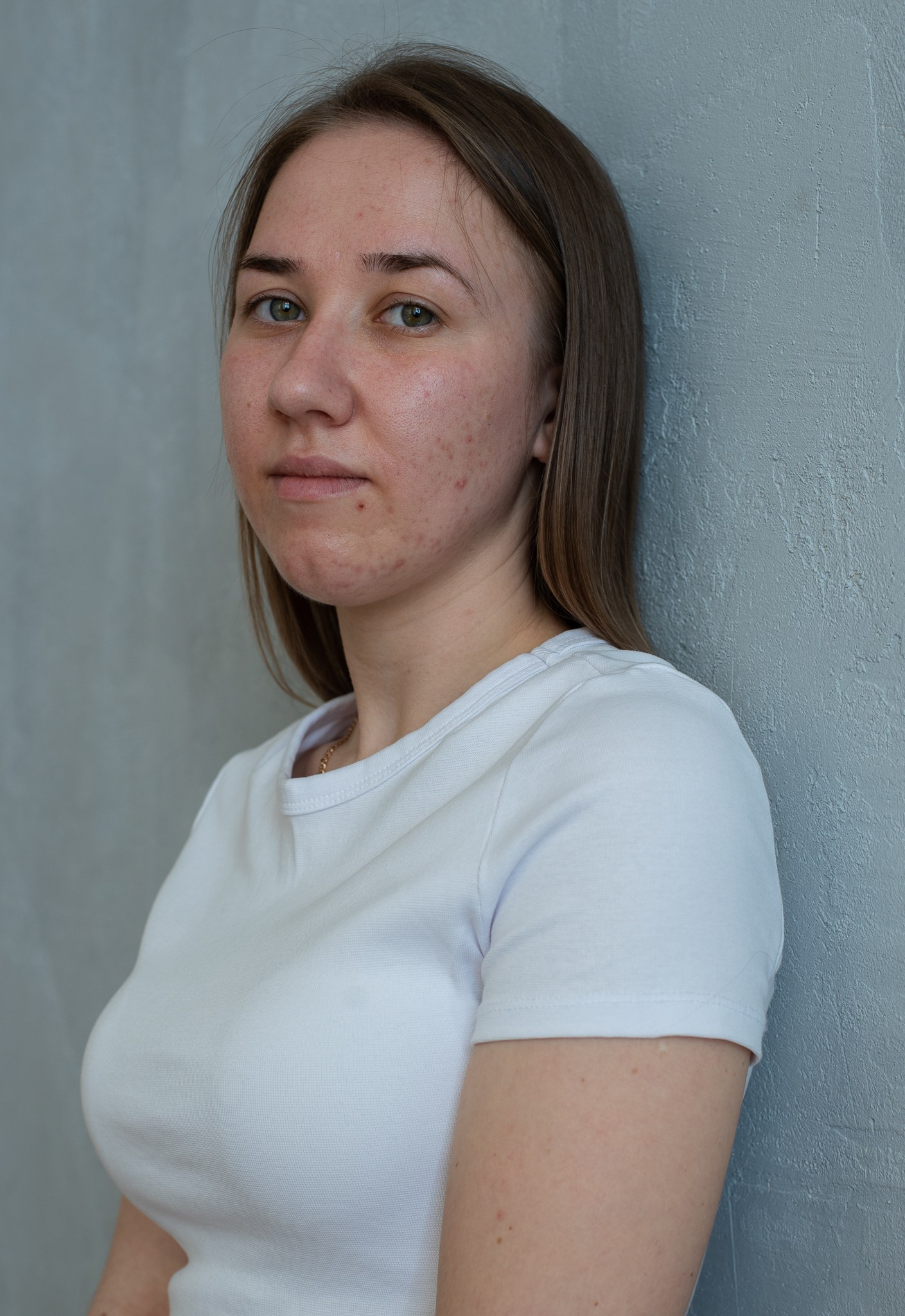 Skin. Документальный и репортажный фотограф Айгуль Михайлова