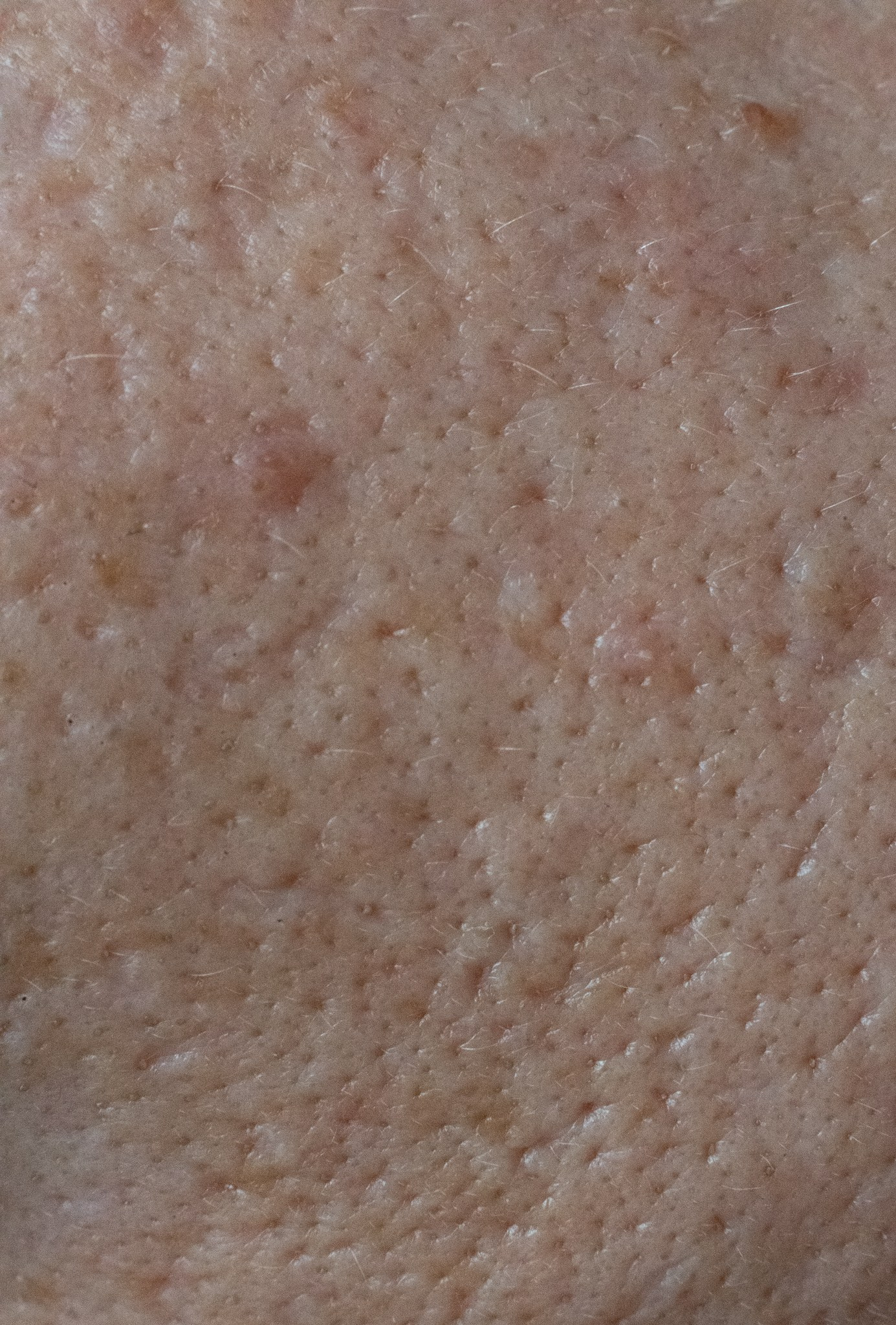 Skin. Документальный и репортажный фотограф Айгуль Михайлова