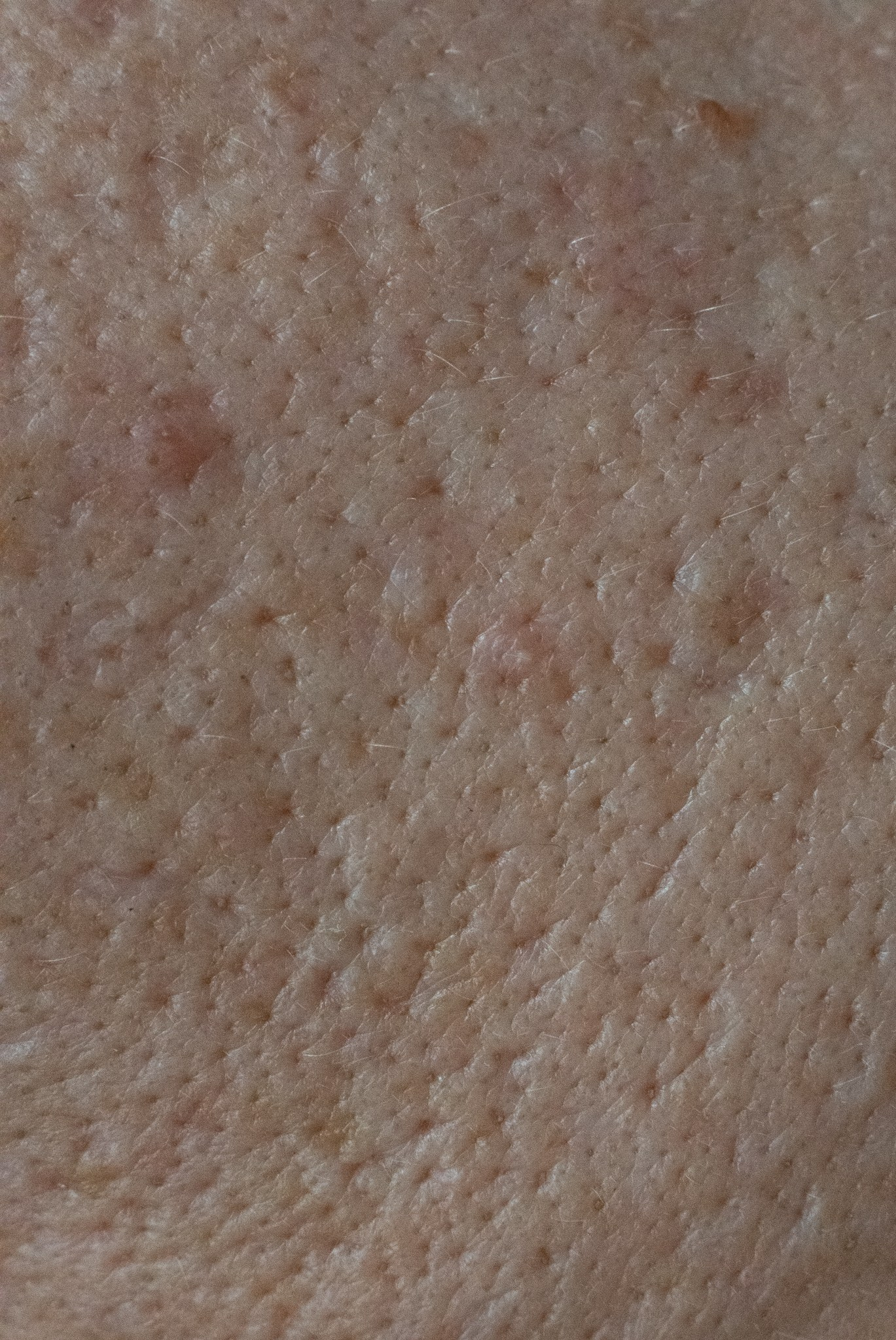 Skin. Документальный и репортажный фотограф Айгуль Михайлова