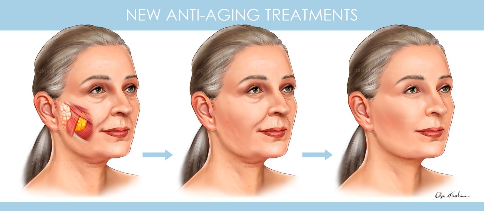 Professional freelance medical illustrator