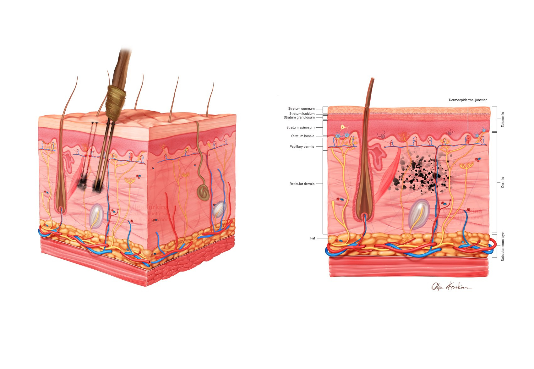 Professional freelance medical illustrator